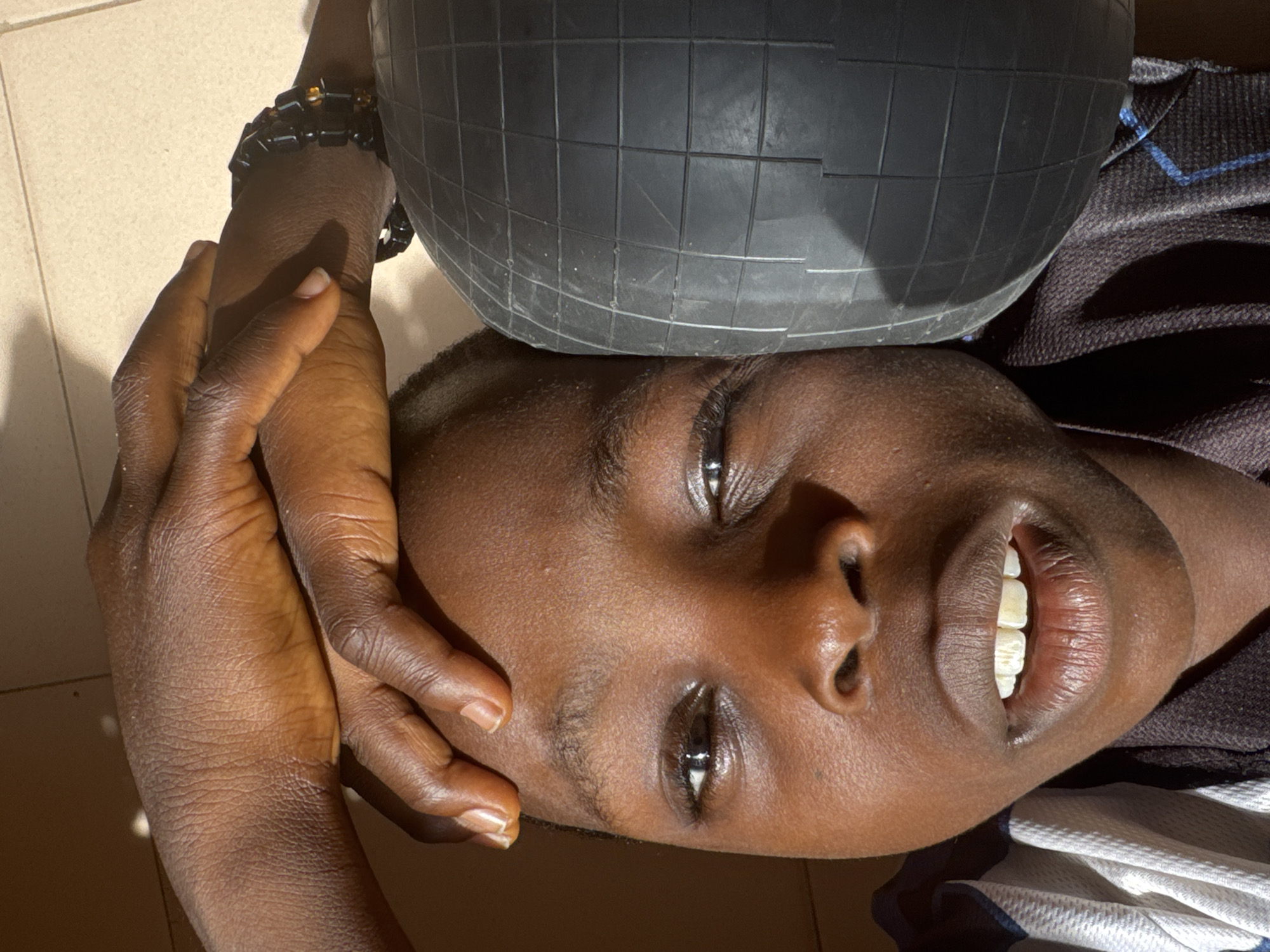 The image shows a person lying down with a black, spherical object resting on their forehead. The person's face is in the foreground, angled towards the camera. Their right hand, adorned with a bracelet, is positioned near their forehead. The person has dark skin, dark eyes, and is partially smiling, revealing their teeth. The background is a neutral color, possibly a tiled floor. Part of the person's clothing, a dark fabric with a blue pattern, is visible on the right side of the image. There is no definitive information in the image itself to confirm the location is Onitsha, Nigeria. The scene is indoors and well-lit.