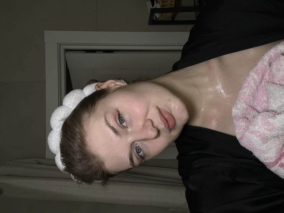 A woman with fair skin, blue eyes, and light brown hair is pictured close-up, wearing a fluffy white headband and a black top. Her face and neck glisten with moisture, possibly sweat or lotion. A pink and white striped towel rests on her shoulder. The background is a dimly lit room with a doorframe and what appears to be a shelf or small cabinet. The image is angled, with the woman's head tilted to the side.