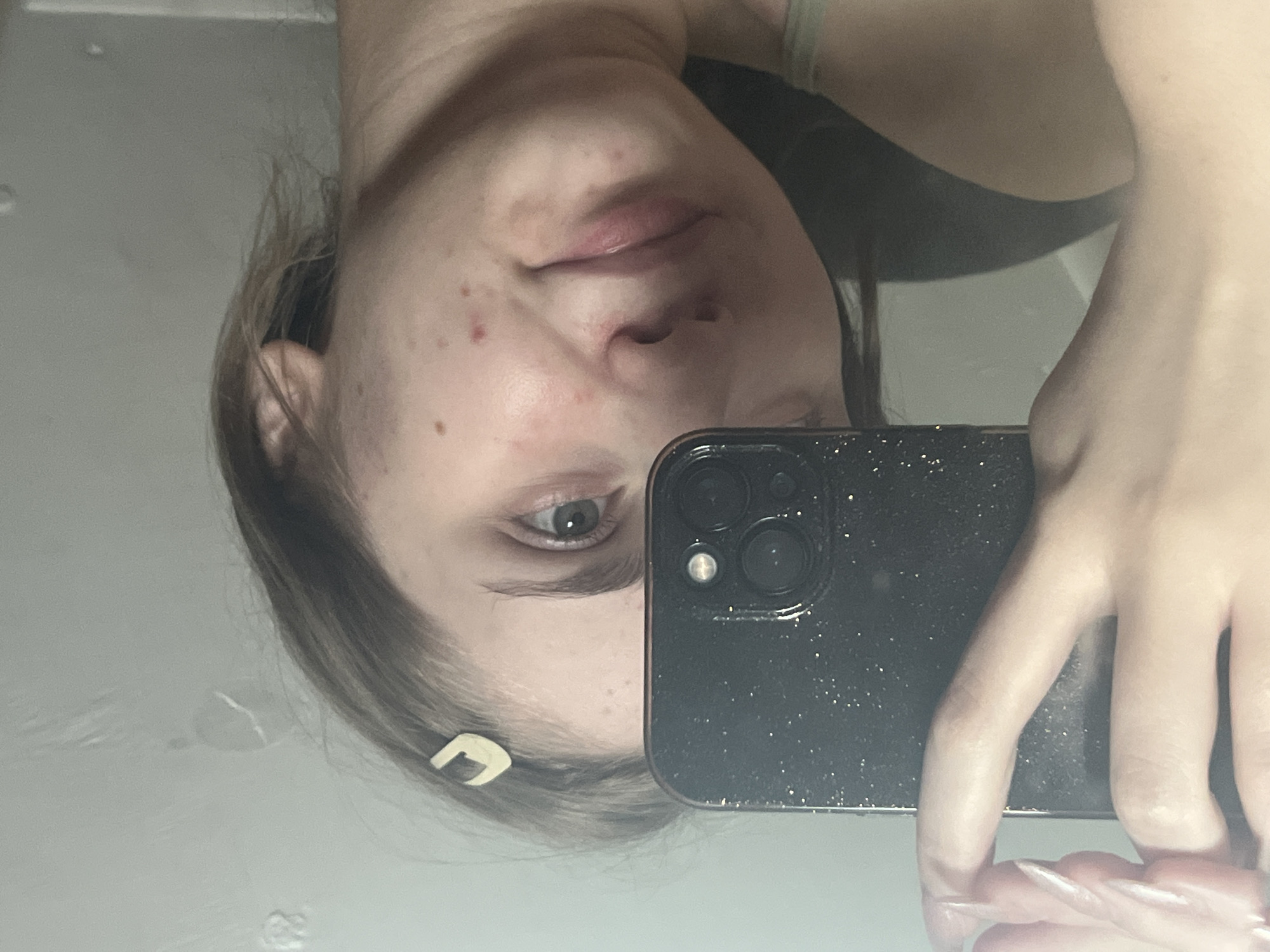 The media file is a close-up, vertically-oriented selfie taken in a mirror, showing a person's face and a smartphone. The person's face is partially visible, with focus on their eye, nose, and lips. They appear to have some acne or blemishes on their cheek. Their hair is brown and pulled back, with a light-colored hair clip visible. The person is holding a black smartphone with a glittery case, which is capturing the reflection. The background appears to be a bright, possibly tiled surface, suggesting a bathroom or similar setting. The lighting is bright, indicating daytime. There are no discernible emotions conveyed. The location is Ashkadar, Russia.