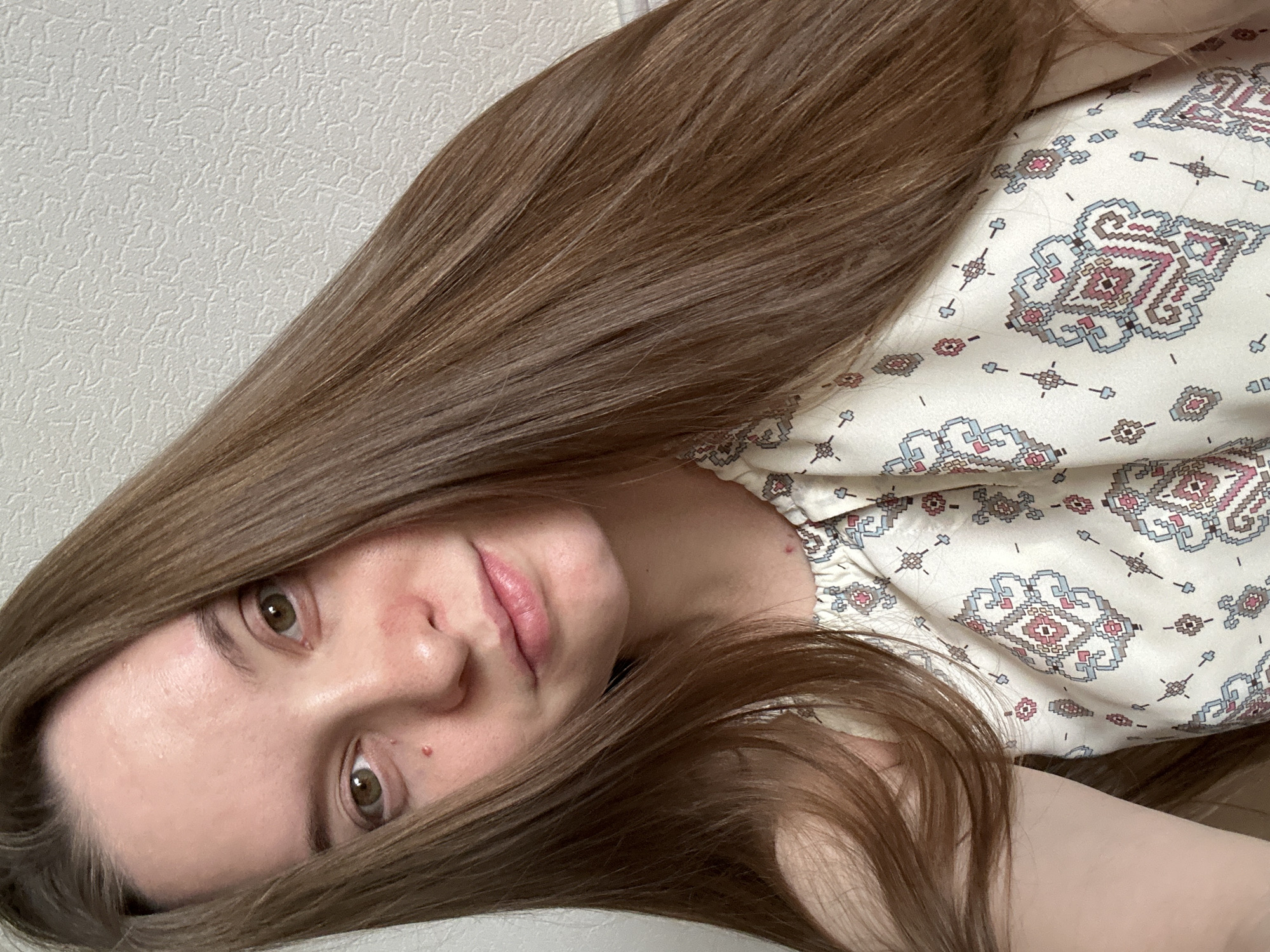 A young woman with long, brown hair is pictured from the chest up, tilted slightly to her left. Her eyes are a light green, and she has fair skin with some redness on her cheeks and nose, along with a small blemish on her cheek. She is wearing a light-colored, patterned sleeveless top with a bohemian-style print. The background is a textured, off-white wall. The image appears to be a selfie taken indoors. There is no identifiable information about the location in Noviy, Russia.