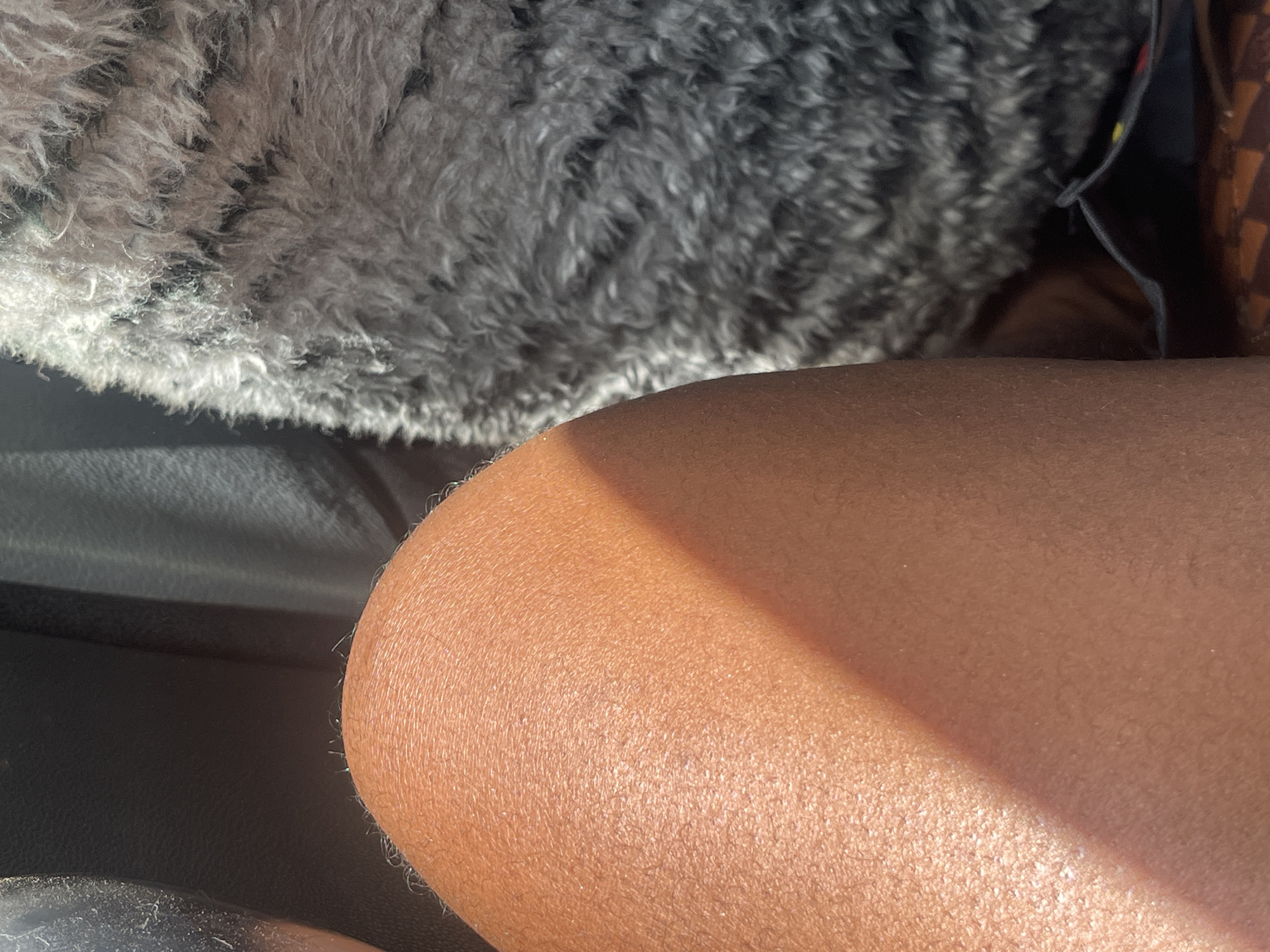 The image presents a close-up view of a person's arm resting next to a fuzzy, grey object. The arm has a light brown skin tone, and the texture of the skin is visible, with a light sheen suggesting a smooth surface. Part of a car seat can also be seen next to the arm. There is no information available to determine that this photo was taken in Nyanya, Nigeria.