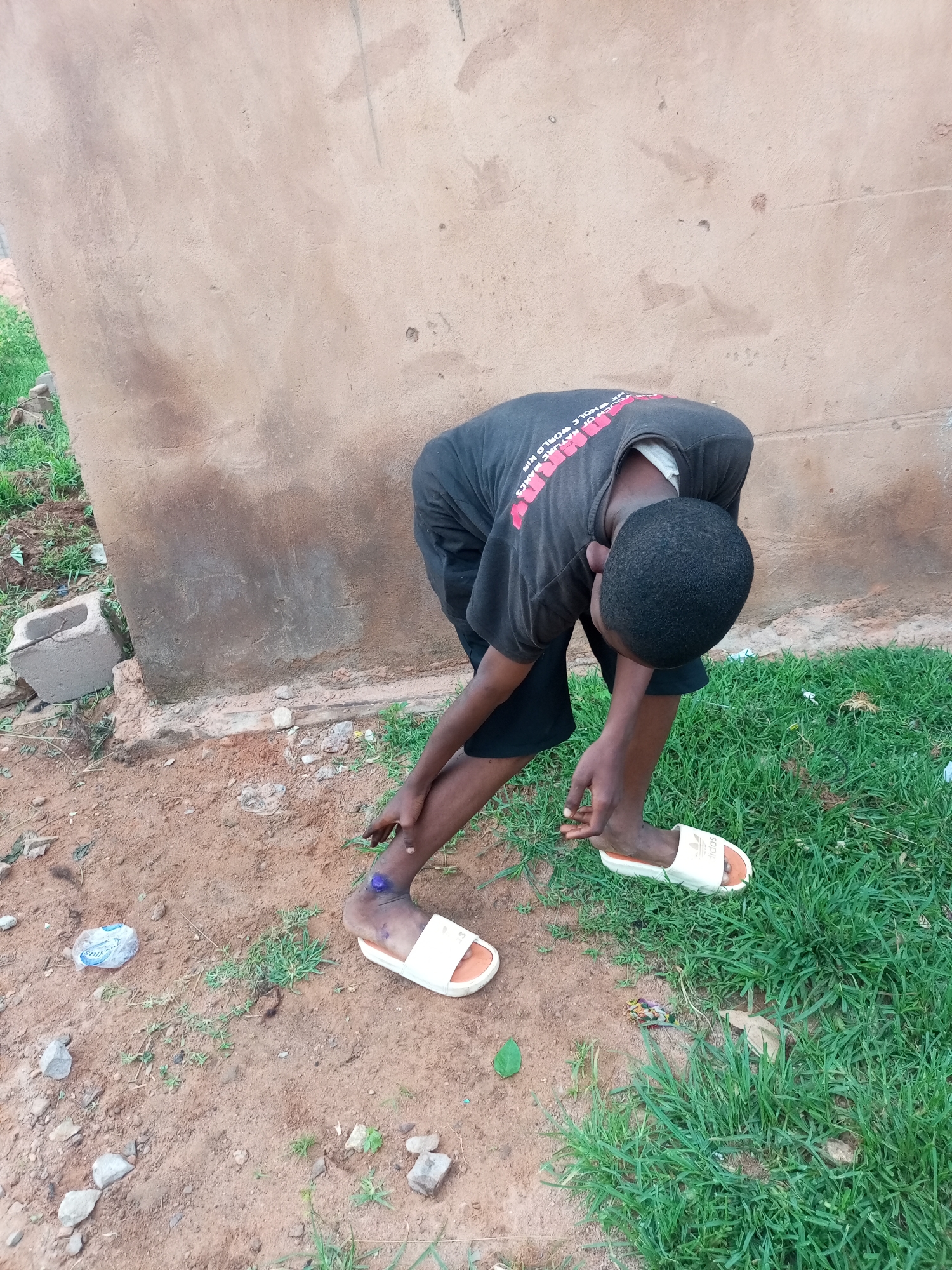 A young Black boy, wearing a black t-shirt with red lettering and black shorts, is seen from behind, bent over. He is standing in what appears to be an outdoor area with a dirt and grass ground. A light-colored concrete block is visible to the left, and a dirty, light-brown wall is behind him. The boy is barefoot except for a white slide sandal on his right foot, and a similar sandal is on his left foot, although it is mostly obscured. There is a visible wound or mark on his lower left leg, above the sandal, with a purplish color. A crumpled plastic bottle is on the ground near his left foot. The scene suggests a simple, possibly rural or less developed, urban environment in Tempure, Nigeria.