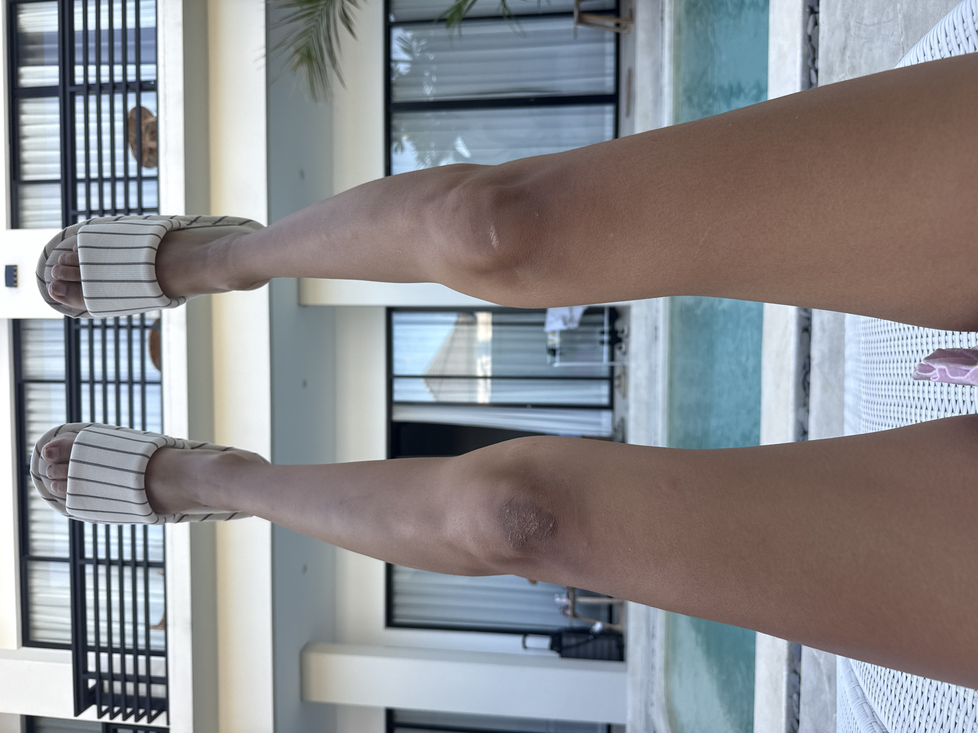In North Kuta, Indonesia, a person is captured from a low-angle perspective, with their legs extended upwards and outwards, resting on a white woven surface, possibly a lounge chair. They are wearing white striped slide sandals. The background reveals a modern resort-style building with multiple floors and balconies, suggesting an outdoor poolside setting. A turquoise swimming pool is visible in the midground. The lighting indicates it is daytime, with shadows cast by the architecture. The scene is devoid of other individuals or immediate interactions.