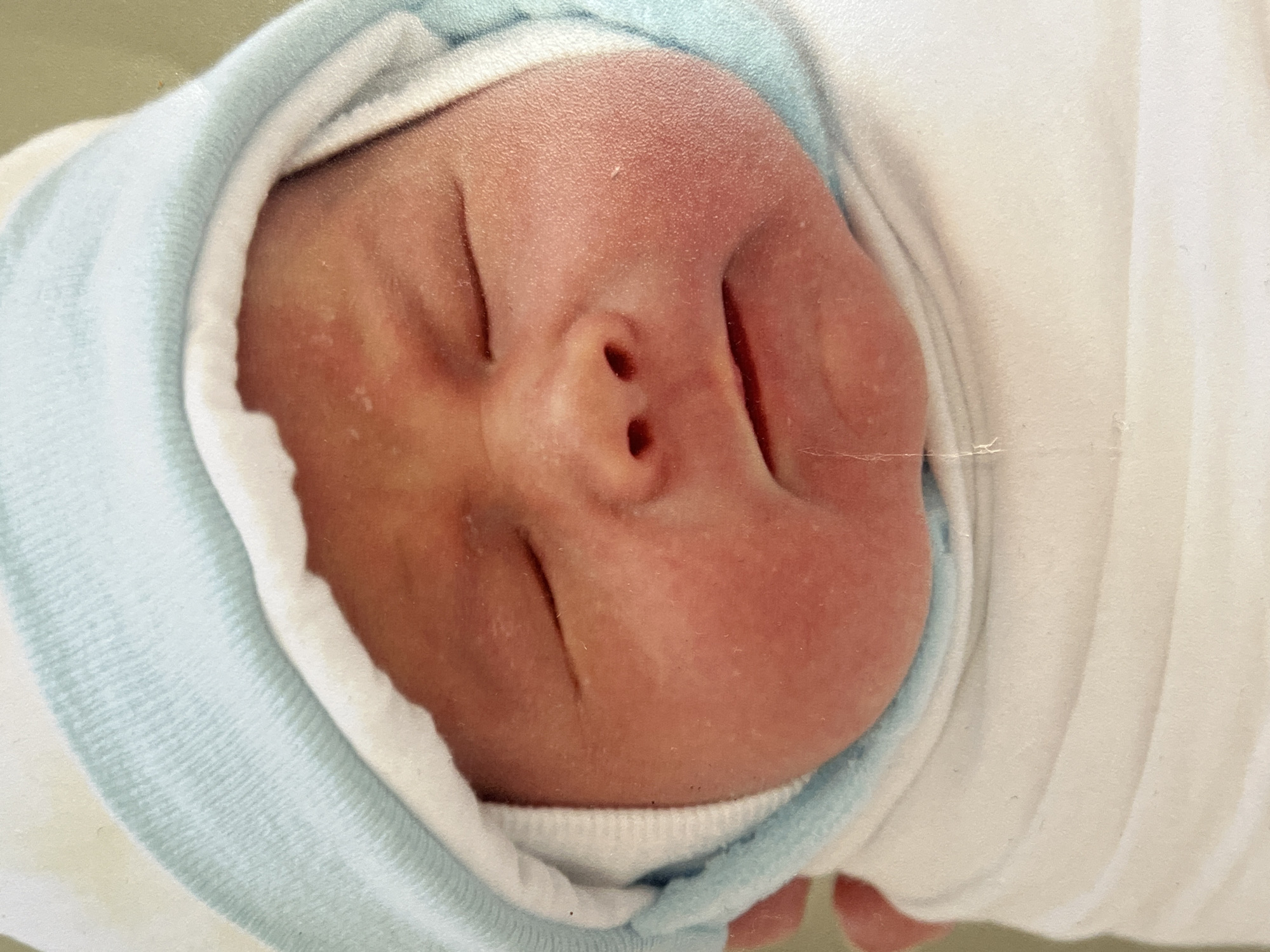 A close-up, eye-level shot shows the face of a newborn baby wrapped in a white blanket and wearing a light blue and white striped hat. The baby's eyes are closed, and its face is flushed. A thin line of drool extends from the corner of its mouth. The background is a soft, out-of-focus beige. There is no indication of location in Saratov, Russia, or any specific environment.