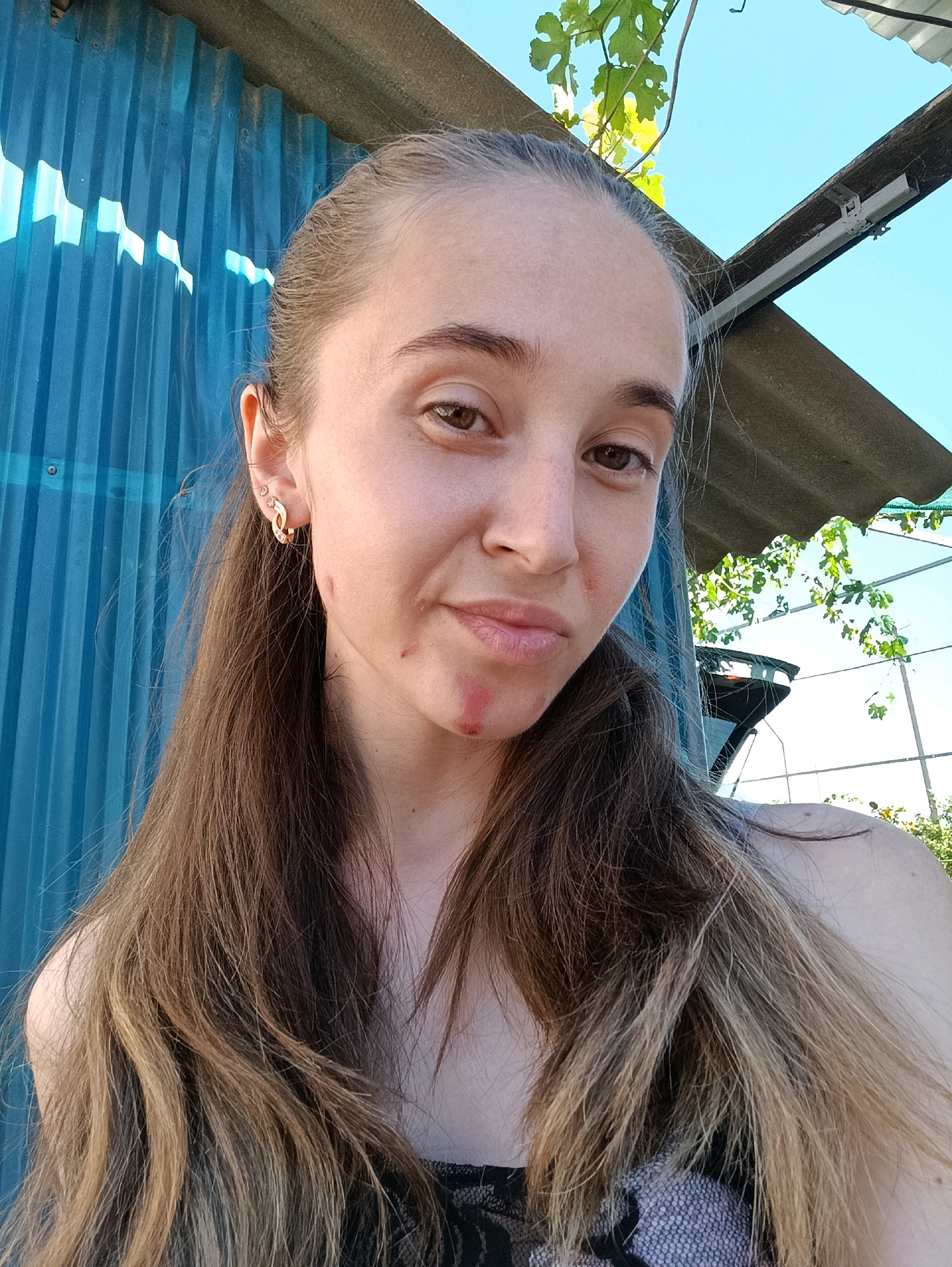 A young woman with long, brown, wavy hair is taking a selfie outdoors. She is looking directly at the camera with a neutral expression. There are some small red marks on her chin and cheek. She is wearing a patterned top. Behind her is a blue corrugated metal wall and a grey, sloped roof with green leaves hanging from vines. The sky is visible and appears clear and blue. The location is Vypasne, Ukraine.