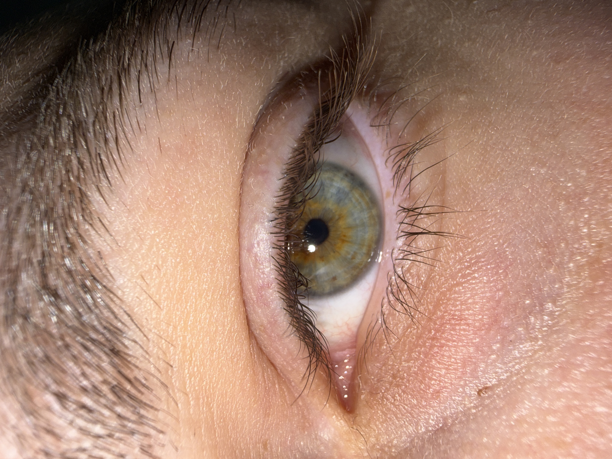 An extreme close-up, macro photograph showcases the left eye of a person, observed from a slightly upward and side angle. The central focus is the open eye, featuring an iris that displays a striking blend of blue-green tones with a prominent amber-gold ring immediately surrounding the dark, circular pupil. A distinct white reflection of a light source is visible within the pupil.
Long, dark eyelashes frame both the upper and lower eyelids, with some instances of subtle clumping visible along the lower lash line. Part of a thick, dark eyebrow is visible in the upper left quadrant of the frame. The surrounding skin appears light-toned, exhibiting fine pores and sparse, light-colored vellus hair across the eyelid and adjacent facial areas. Subtle reddish undertones are apparent in the delicate skin, particularly around the lower eyelid and the pink lacrimal caruncle.
The image is brightly lit, accentuating skin texture and individual hairs, against a dark, out-of-focus background. No specific activity or emotion is discernible beyond the eye being open. There is no visible text. This photograph was taken in Stara Zagora, Bulgaria.
