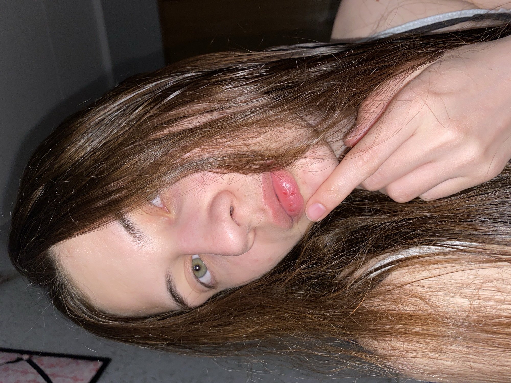 A young woman with long, brown hair is lying down, her face tilted towards the camera. She has a blister or sore on her lower lip, which she is touching with the index finger of her right hand. She has green eyes. The background is dark and indistinct, but a small portion of the floor is visible. The location in the city of Votkinsk, Russia, cannot be determined from the image.