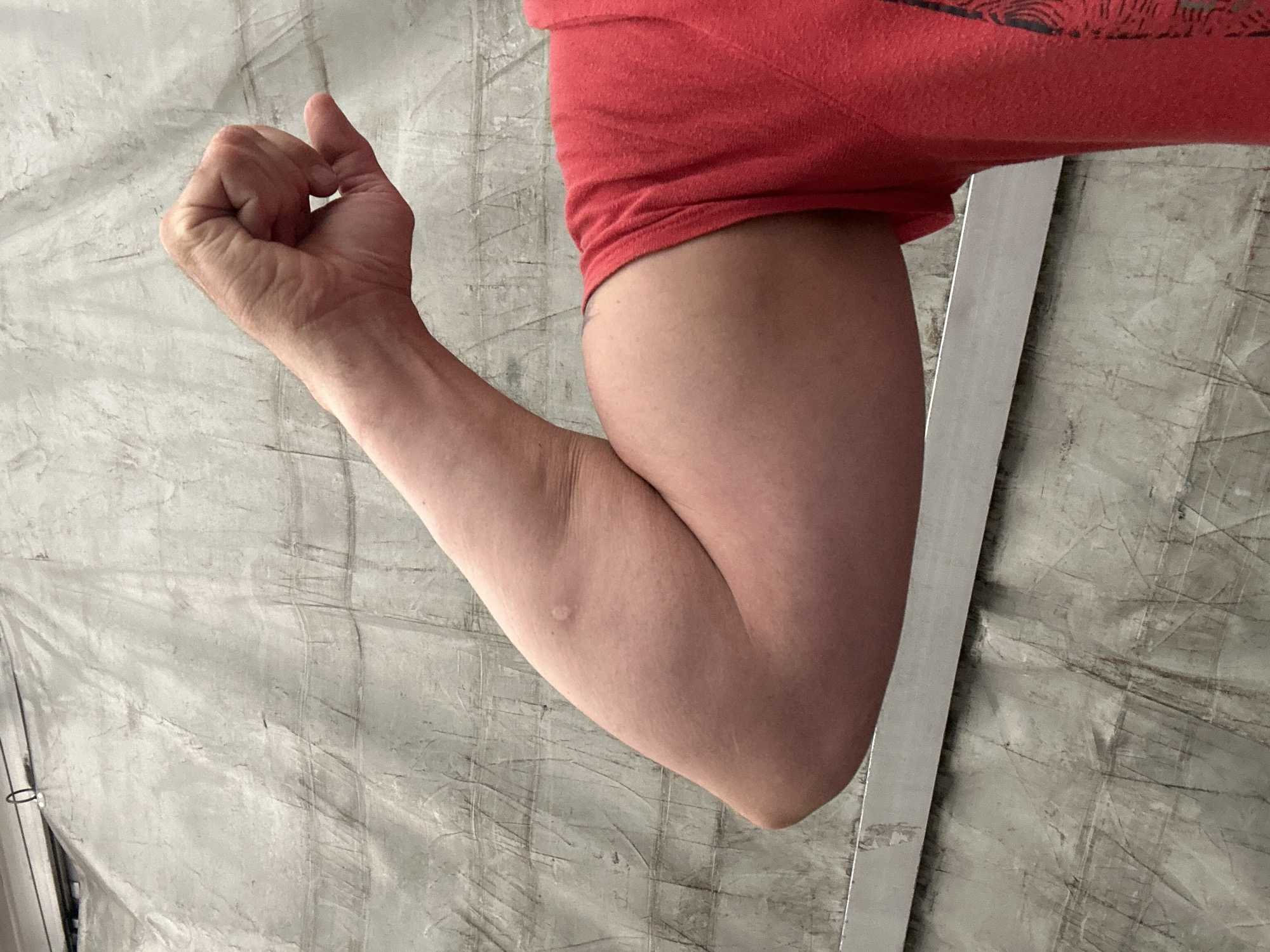 A person's right arm and upper torso are visible, posed against a textured grey background. The arm is bent at the elbow, with the fist clenched and thumb extended upwards. The skin on the arm appears fair and slightly flushed. A small, raised bump is visible on the outer part of the bicep. The person is wearing a red t-shirt, the fabric of which is visibly textured. A metallic silver bar runs horizontally across the lower part of the image, separating the arm from the background. The background itself appears to be a large tarp or fabric with a crinkled texture, possibly a construction site or outdoor covering. There is no identifiable context to pinpoint the location to Dornbirn, Austria.