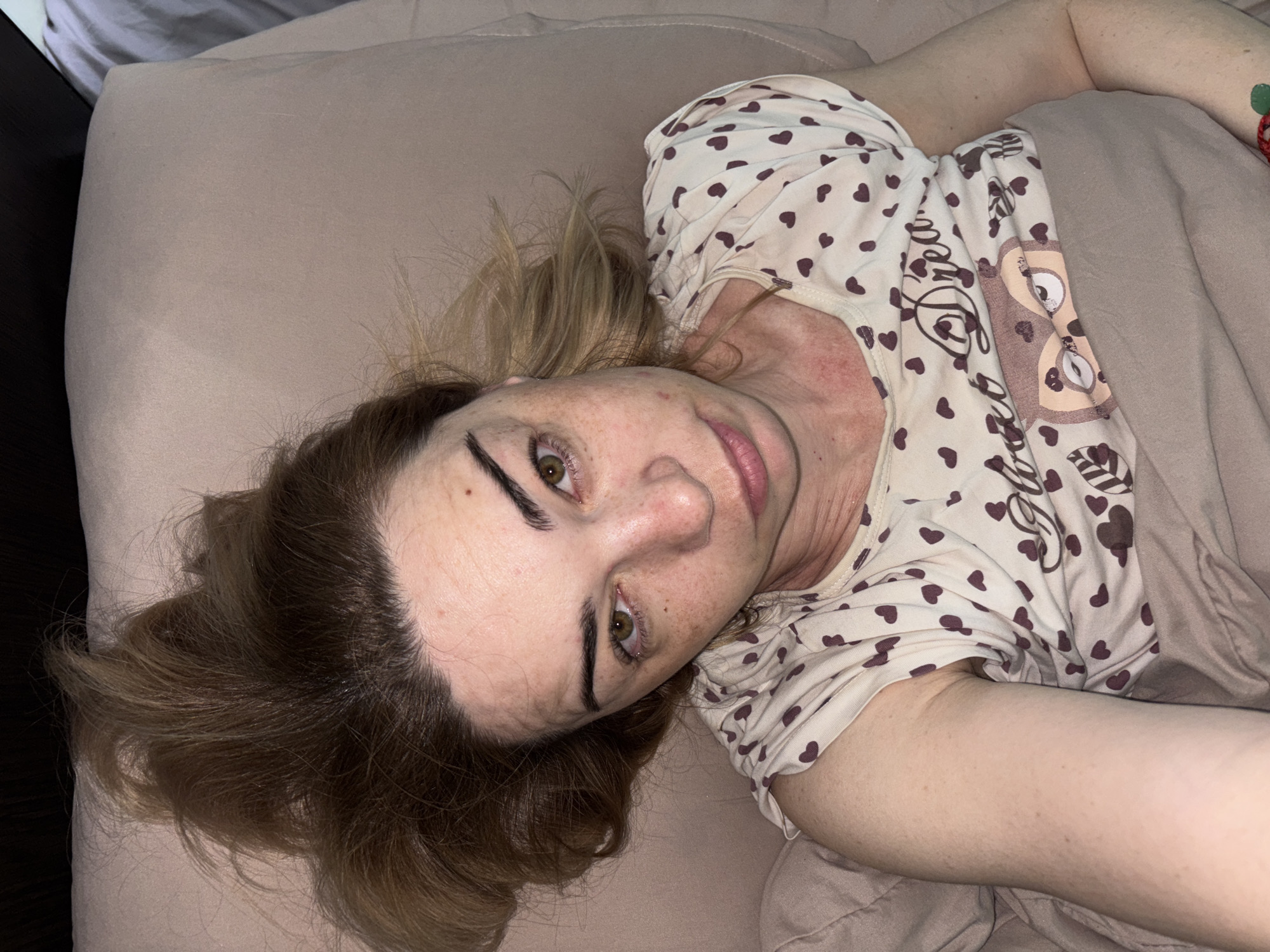A woman lies in bed, looking directly at the camera. She has light brown hair that is messy and appears to be unstyled. Her eyes are open, and she has prominent eyebrows. Her face has freckles and some redness around her neck and chest. She is wearing a light-colored t-shirt with a pattern of dark pink hearts and an owl graphic that says "Dream." She is covered by a light brown blanket. The background consists of a light-colored pillow and a dark background, suggesting she is indoors. The scene is consistent with a bedroom environment, likely in Vsevolozhsk, Russia, given the context.