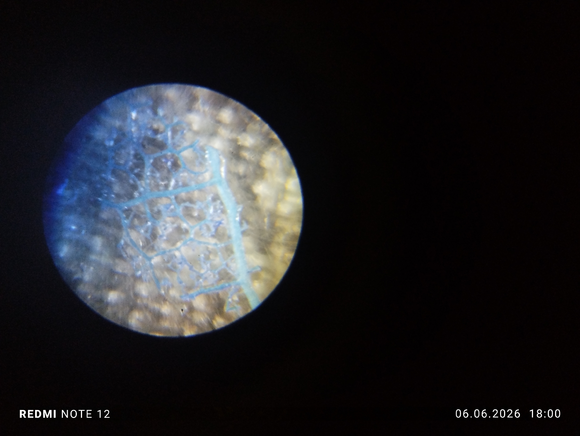 A digital photograph, captured by a Redmi Note 12 device on June 6, 2026, at 18:00, depicts a magnified biological specimen observed through a circular optical field, presumably a microscope eyepiece. The image was recorded in Burgas, Bulgaria. The central subject is a network of delicate, interconnected, light blue branching structures, consistent with stained vascular tissue or hyphae, set against an indistinct, mottled light brown and grey background within the circular field of view. The area surrounding this circular field is uniformly black. No human subjects, specific actions, or other identifiable objects beyond the magnified specimen are present within the visual frame.