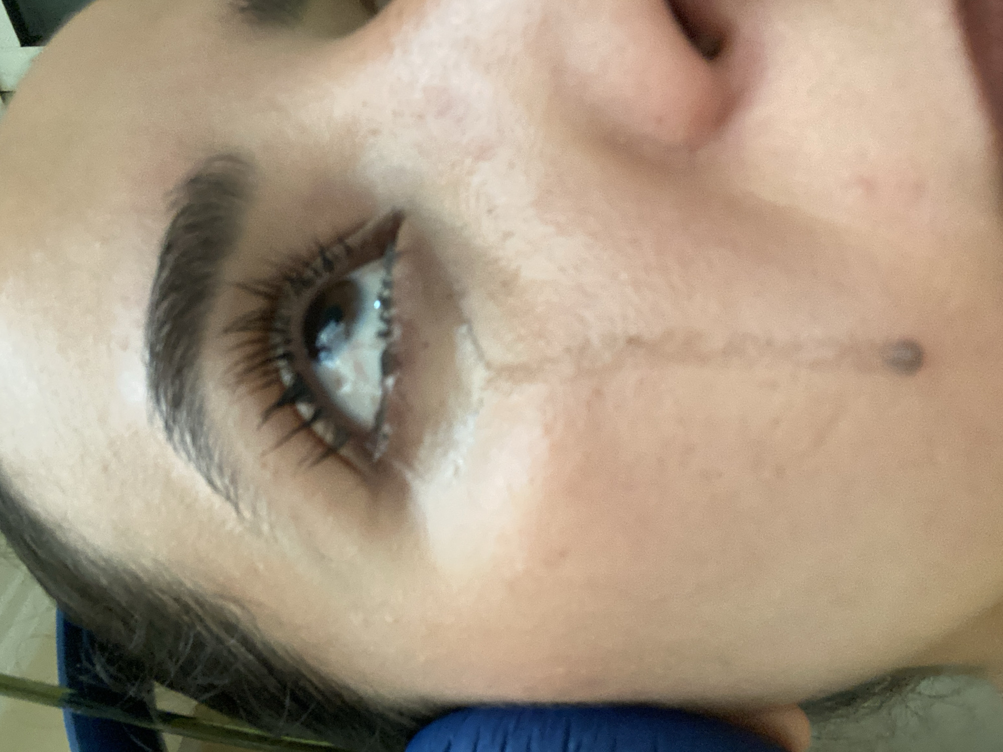 A close-up, rotated view of a person's right eye and part of their face is presented. The image is oriented such that the person's head appears turned sideways, with the eye looking upward. The individual has dark, long eyelashes, possibly enhanced with mascara, and a well-defined dark eyebrow. Their skin tone is medium.
A prominent dark, streaky line, likely caused by liquid (such as tears) mixing with makeup, runs from the inner corner of the eye horizontally across the cheek towards the temple area. A small, dark mole or blemish is visible on the skin at the end of this streak. The eye itself appears glossy and wet, suggesting the presence of tears.
Dark hair is visible along the side of the face and temple. A blue object, possibly an item of clothing or a pillow, is visible underneath the chin and neck area. The overall scene is a detailed portrait of a face, focusing on the eye and the streaked mark, which might imply crying or irritation. No text is visible. There are no discernible elements within the image itself to indicate time of day, weather, or a specific location like Agadir, Morocco.