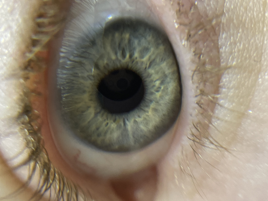 This image is an extreme close-up, macro shot of a human eye, likely taken for detailed observation of its features. The central and most prominent feature is the iris, which displays a complex and beautiful pattern of varying shades of light green, blue, and possibly some yellow or hazel tones. Radial striations and intricate crypts are clearly visible within the iris, extending from the pupil outwards towards the limbus, which is the slightly darker outer ring of the iris.
The pupil is perfectly round and appears intensely black, situated in the center of the iris. A small, circular reflection of a light source, suggesting an overhead or ring light, is visible within the pupil, indicating a well-lit environment.
Portions of the white sclera are visible surrounding the iris, particularly at the top, bottom, and sides. At the bottom-right edge of the sclera, there is a very faint hint of a reddish spot or tiny blood vessel, observable upon close inspection.
Both the upper and lower eyelids are partially visible, framing the eye. The eyelashes are light brown or blonde and are particularly noticeable along the upper eyelid, where they appear quite dense and show individual strands. The skin of both the upper and lower eyelids exhibits fine texture, including subtle lines and pores. Some sparse, lighter-colored eyelashes are also visible along the lower lid.
The overall impression is one of remarkable detail and clarity, highlighting the unique biological patterns of the human iris. There is no discernible background beyond the immediate vicinity of the eye, nor any text visible in the image. No specific activity or emotion can be inferred from this static, highly magnified view.
