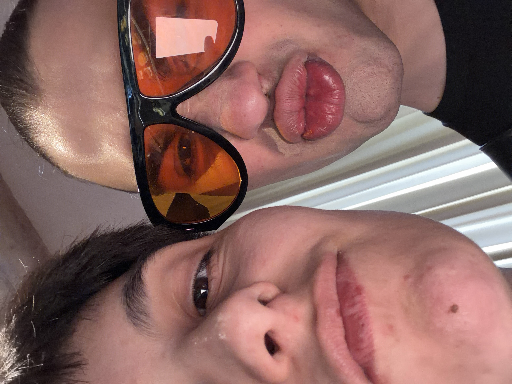 The image shows two people in a close-up, unusual composition. The person on the top is wearing black-rimmed sunglasses with orange lenses, which reflect the face of the person below. The top person's lips are pursed forward in a kiss or pout. The lower person is positioned with their face partially visible, primarily focusing on their nose, eye, and part of their mouth. The background features a series of horizontal, bright, blurry lines, which could be Venetian blinds. There is no specific information suggesting the image's location is Yerevan, Armenia, or any information about actions or interactions between them. The image is taken from a low-angle perspective.