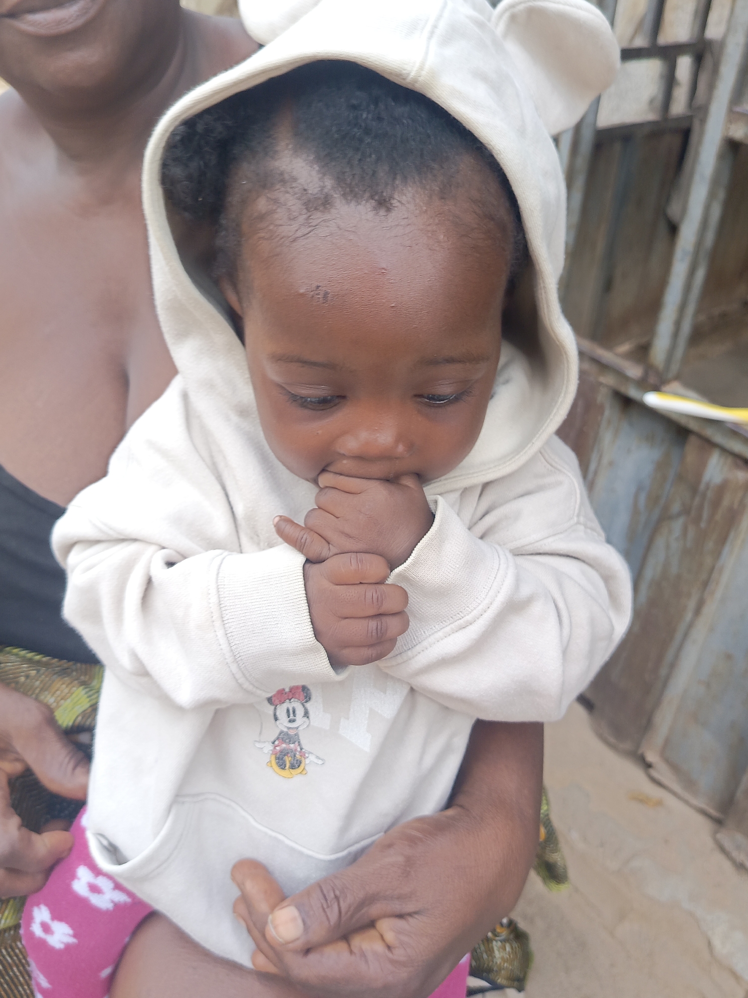 In Akwanga, Nigeria, a baby with dark skin and short, curly hair is held by an adult. The baby is wearing a light-colored hooded sweatshirt with a Mickey Mouse graphic and has pink floral-patterned leggings. The baby is looking down and has their hand in their mouth. The adult holding the baby is wearing a black top and has patterned fabric draped across their arm. The background shows a metal fence and a partially visible building.
