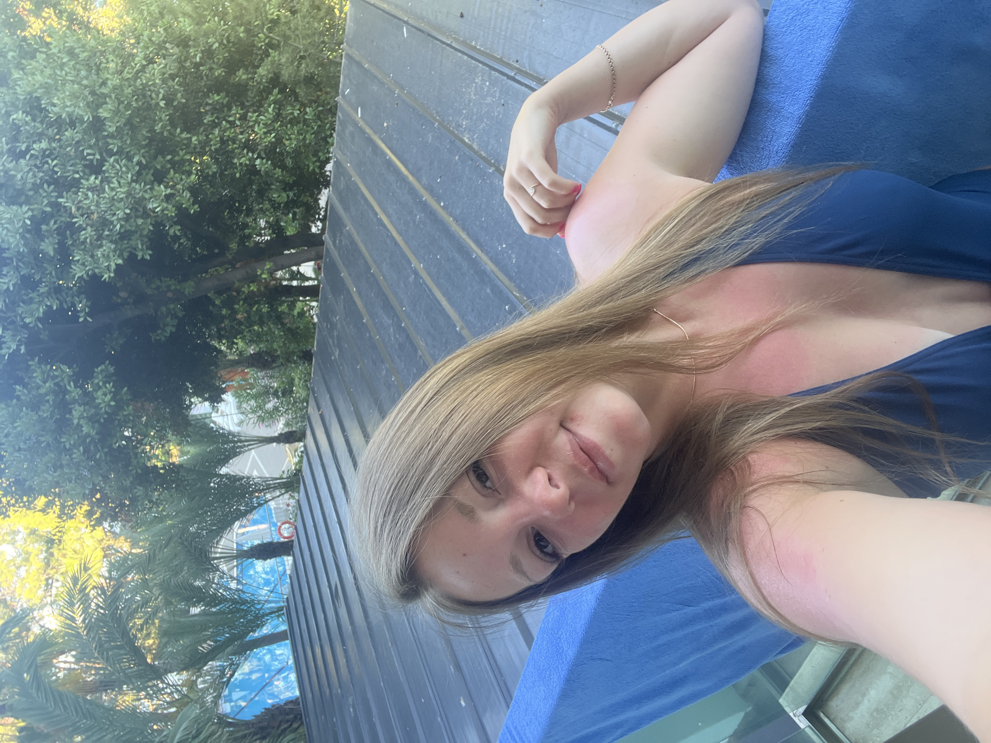 The media file is a selfie taken outdoors, likely in Alanya, Turkey. The subject is a young woman with long blonde hair, wearing a blue swimsuit. She is lying down, possibly on a lounge chair, as indicated by the blue fabric underneath her. Her skin appears red and slightly sunburnt on her shoulders and arms, suggesting a sunny day. The background shows a wooden deck or walkway, with lush green trees and palm trees visible. In the distance, part of a building with a blue exterior is visible, along with a hint of a swimming pool. The lighting suggests it is daytime, possibly late afternoon, with sunlight filtering through the trees. The woman's expression is relaxed and pleasant, with a slight smile. There is no visible text in the image.