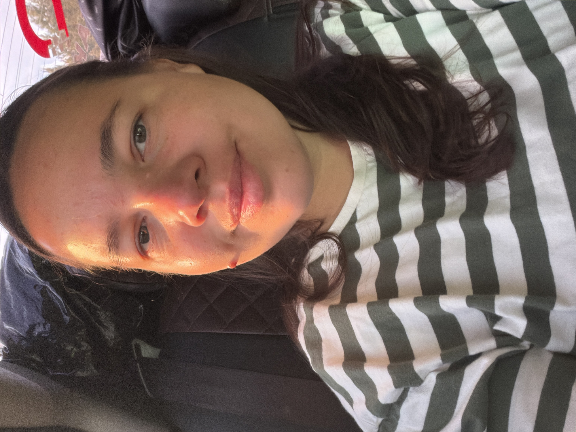 A selfie of a light-skinned woman with dark brown hair and eyes, wearing a horizontally striped white and olive green t-shirt. The photo is taken at an angle. The woman has a small wound on her lower lip. She is sitting in a car; the car seat is black and quilted. The location is Забегалово, Russia, as specified. The lighting is bright and warm, possibly from sunlight.