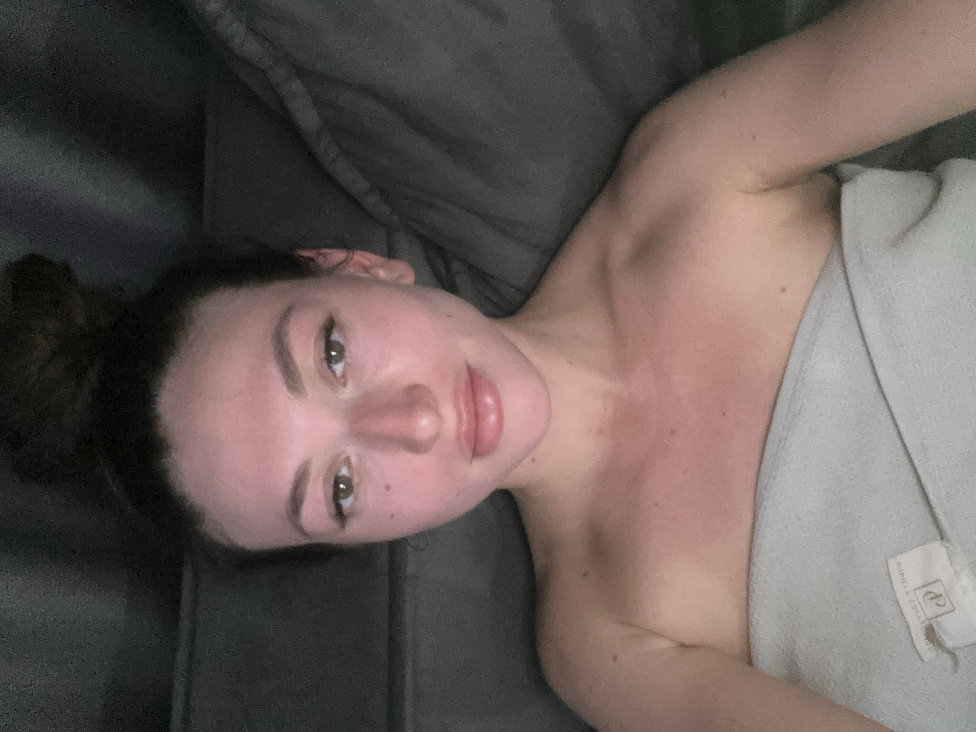 A young woman with dark hair pulled into a messy bun is lying down, wrapped in a light-colored towel that covers her chest and shoulders. She is looking directly at the camera with her eyes open and a slight smile. Her skin appears flushed and red, particularly on her cheeks and nose, and she has a few freckles visible. The background is dark and out of focus, suggesting an indoor setting, possibly a bedroom or living room. There are no discernible landmarks or features that would allow for identification of the specific location within Эстачи, Russia.