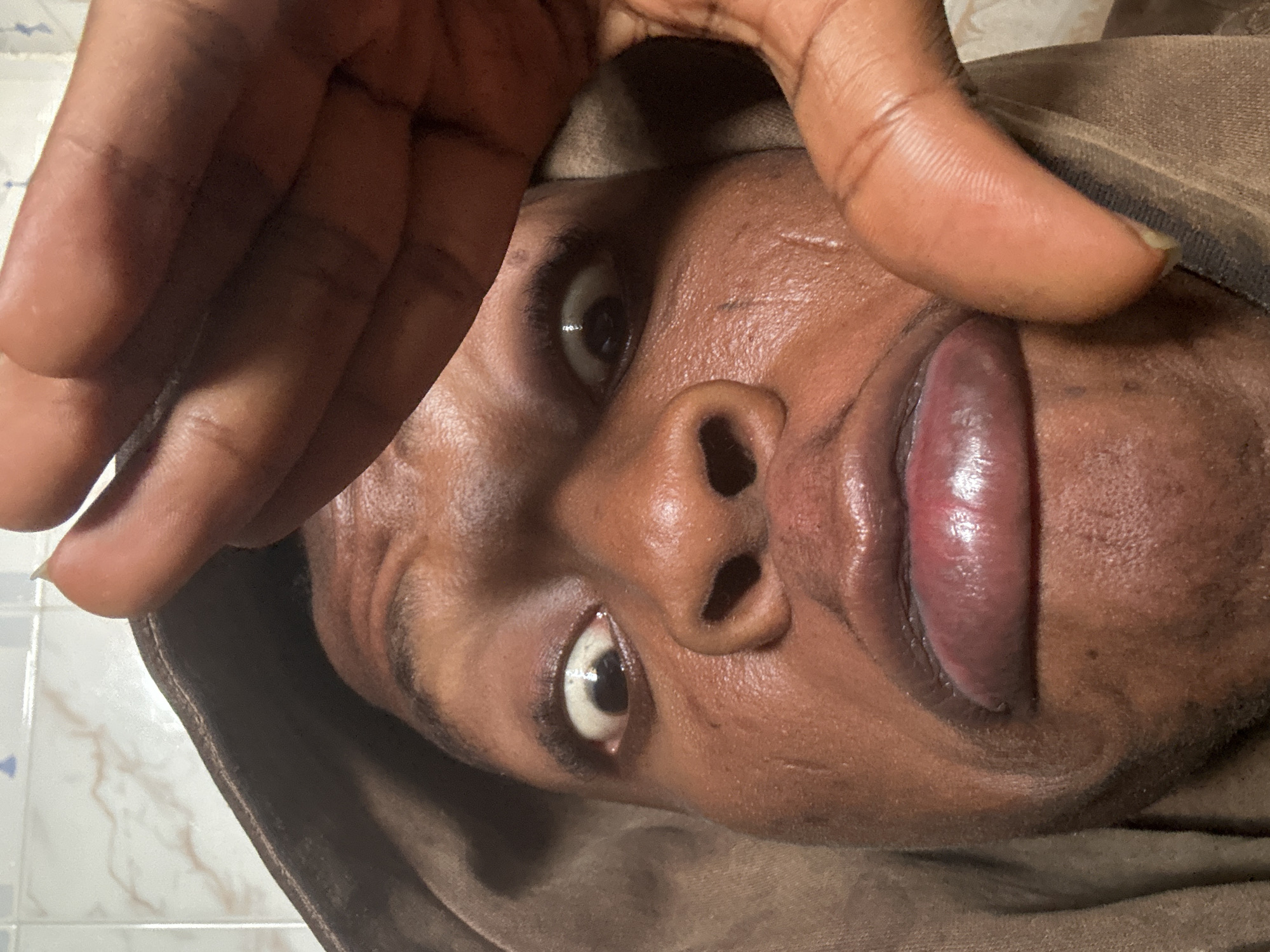 A close-up, low-angle shot shows a person's face from a very close perspective, with their head tilted upwards and to the right. A hand is held in front of the face, with the thumb and forefinger obscuring part of the forehead and the other fingers visible on the left side of the frame. The person has dark skin and is wearing a brown hooded garment. Their eyes are open and looking upwards, with one eye more prominently visible than the other. The lips are slightly parted and appear glossy. The skin has some visible texture and a few small marks. The background is out of focus but appears to be a tiled surface. The image is likely taken indoors. There is no visible text in the image. The lighting suggests it may be daytime, but there are no strong indicators of time of day or weather. The emotions conveyed are difficult to definitively ascertain due to the framing and perspective, but the wide eyes could suggest surprise, or a playful or curious expression. The location context of Ikorodu, Nigeria, does not provide specific visual cues within the image itself.