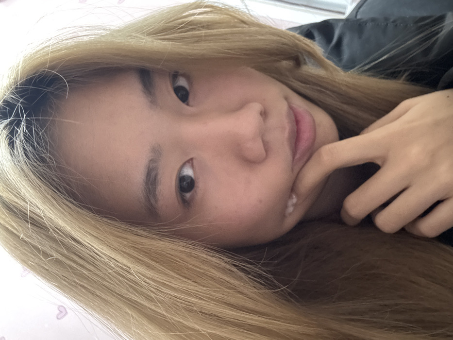 A close-up, head-and-shoulders portrait depicts an East Asian female in an indoor setting, presumably within Shapingba District, China. The subject has long, light blonde hair with visible darker roots. She wears a dark garment. Her left hand is raised, with fingers resting under her chin and against her left cheek. Several small, white, raised dermal irregularities are visible on her left cheek. Her gaze is directed forward. The background consists of a light-colored wall with faint, light pink heart patterns visible on the left.