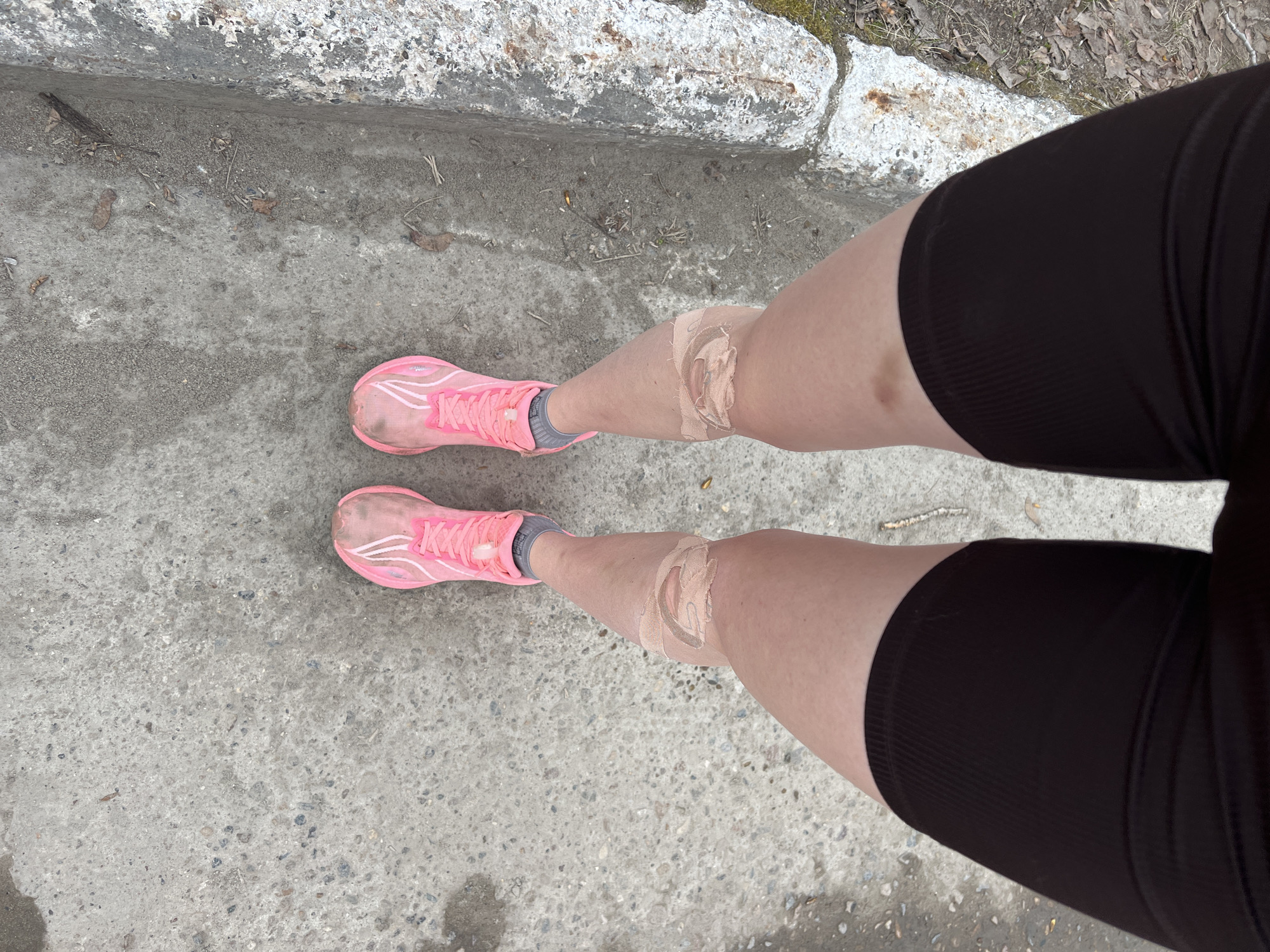 The image shows a person's legs and feet standing on a grey concrete surface, likely a sidewalk or path. The person is wearing black shorts and pink running shoes. There is a large bandage on each knee. The background includes a concrete ledge or curb with some vegetation.
Without additional information or clues in the photo, it is impossible to determine the exact location within the city of Chaikovsky, Russia.