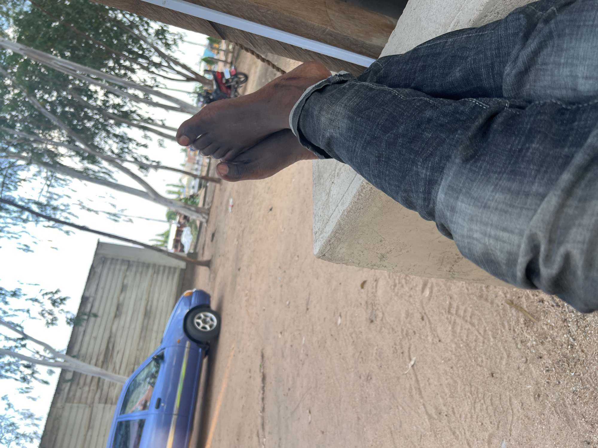 In Mayo Dasa, Nigeria, a person is relaxing outdoors. Their bare feet, with dark skin, are crossed at the ankles and rest on a concrete block. They are wearing dark denim jeans, with the cuffs rolled up. In the background, a blue car is parked on a dirt ground. Several trees with slender trunks and sparse foliage are visible, with thin branches reaching towards a bright sky. A rustic wooden structure with a white vertical beam is to the right. Beyond the trees, a red motorcycle and other structures can be faintly seen. The overall environment suggests a casual, open-air setting.