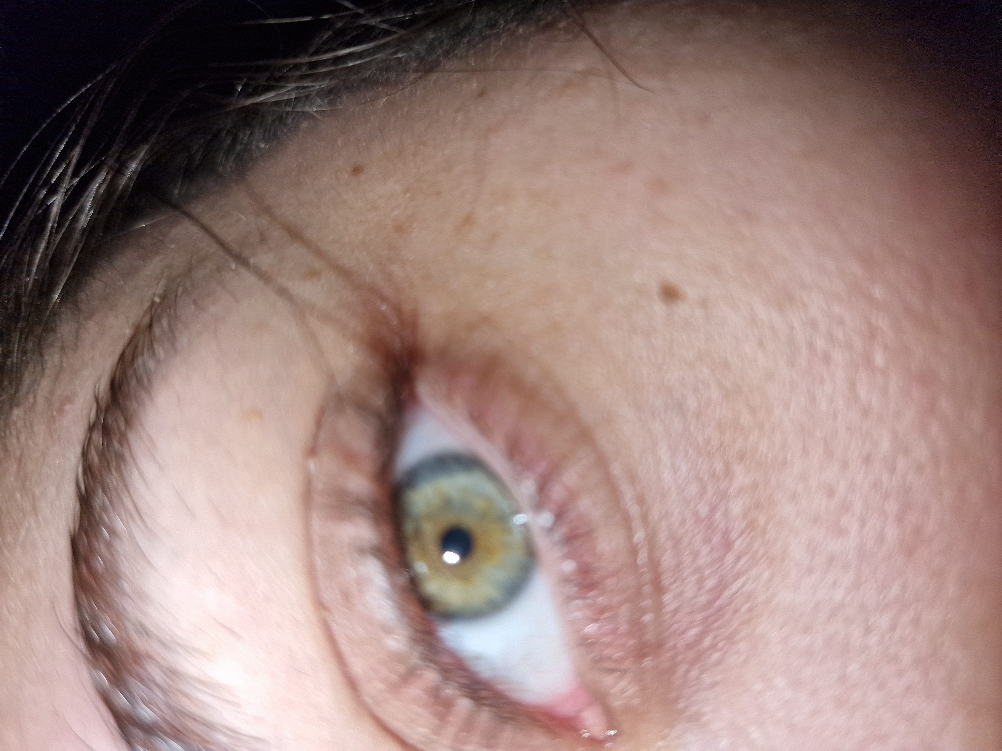 A close-up photograph shows the left eye of a person with hazel-colored iris surrounded by a white sclera. The pupil is black. The lower eyelid has a slight tear. Eyelashes are visible on both the upper and lower eyelids. The eyebrow is brown. The skin around the eye is light and has visible pores, fine lines, and a few small moles. The top of the forehead is visible, with stray dark hairs. There is no evidence to suggest this image was taken in Byala Slatina, Bulgaria.