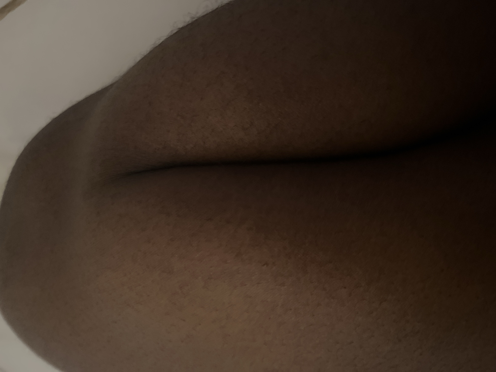 The image displays a close-up view of a person's buttocks. The skin tone is dark, and there is a hint of body hair visible. The lighting suggests an indoor setting, possibly at night or in a dimly lit room, as indicated by the shadows and the overall muted tones. The background is out of focus and appears to be a light-colored surface, possibly a wall or bedding. There are no discernible objects, text, or specific location cues within the image itself, other than the provided context that the location is Abuja, Nigeria. The image focuses solely on the texture and form of the skin.
