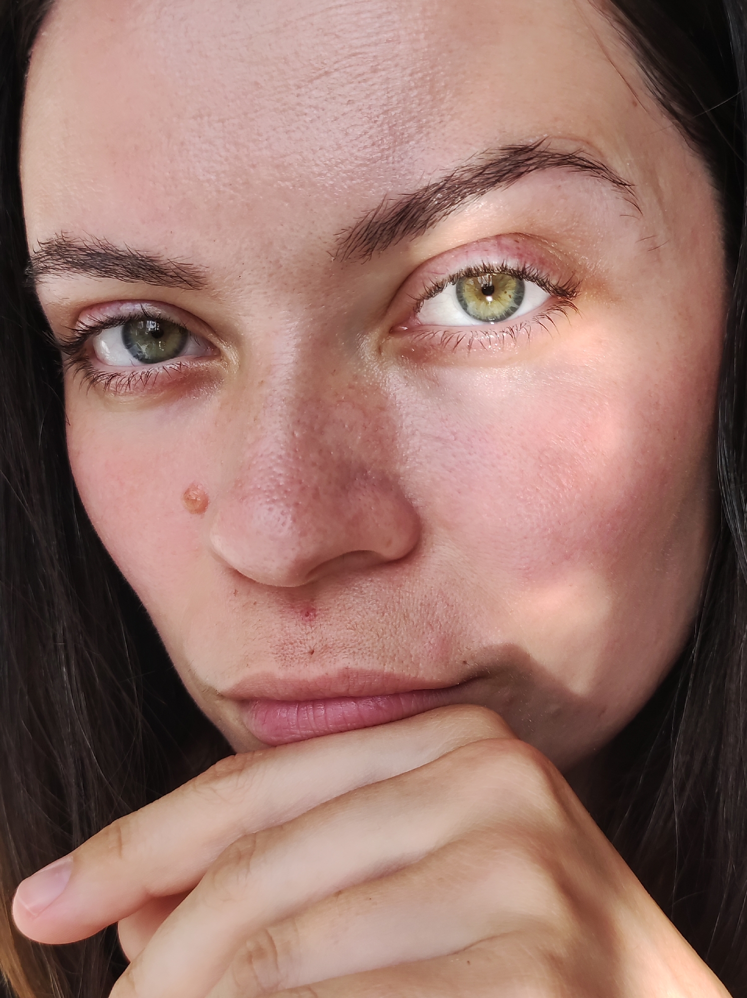 A close-up, high-angle photograph depicts a woman with fair skin and dark brown hair. Her eyes are a mix of green and gold hues. On her left cheek is a raised mole. Another, smaller mole is visible above her lip. Her skin appears slightly flushed. She rests her chin on the fingers of her hand. The background is blurred and indistinct. The location is not discernible from the image.