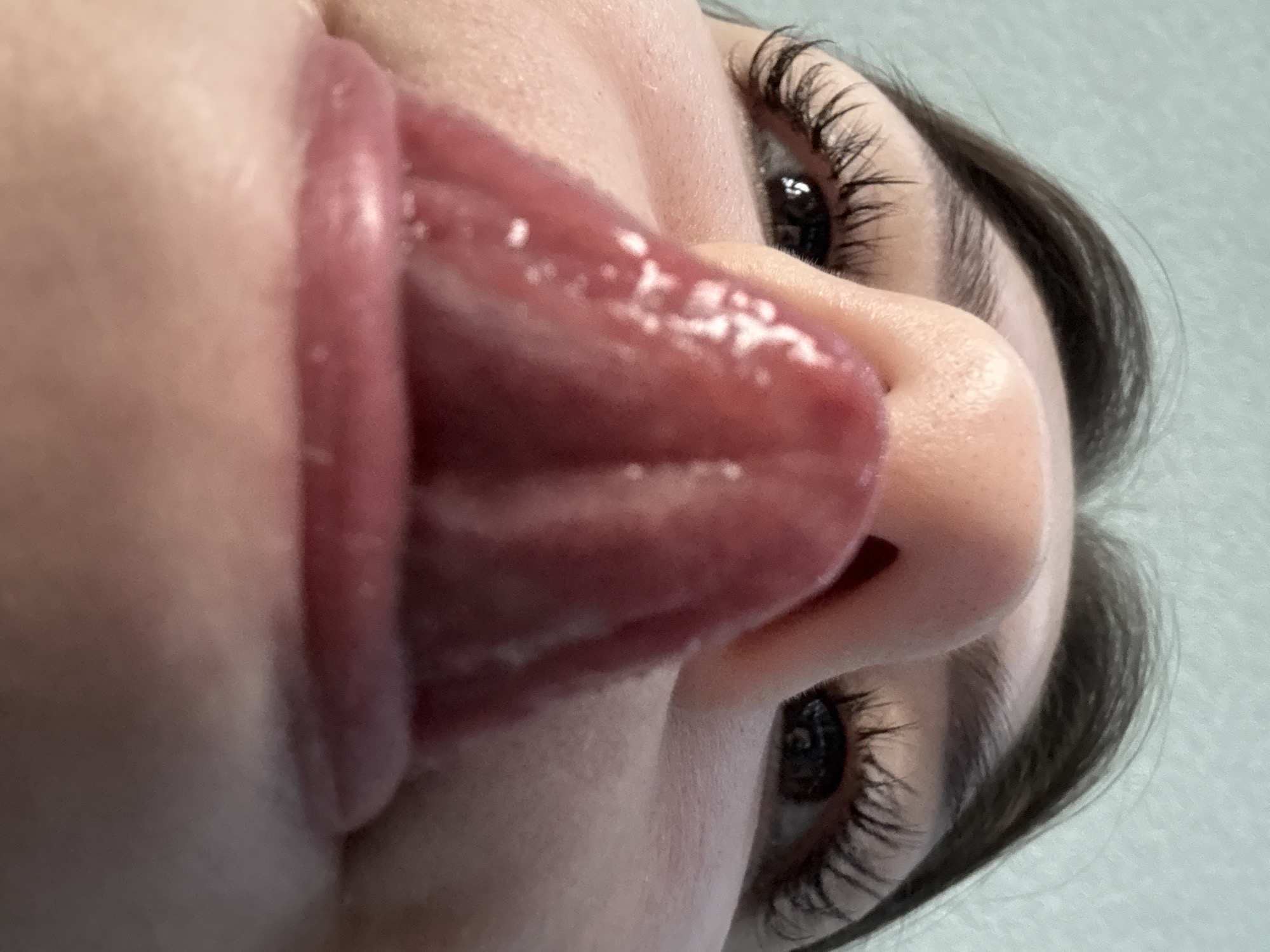 The image is a close-up, low-angle shot of a person's face, primarily focusing on their mouth and eye. The person's tongue is extended and appears to be covered in saliva, with some white spots visible on its surface. The individual has dark eyelashes and eyebrows, and their skin is fair. The background is a light blue, textured surface, possibly a wall or fabric. The lighting suggests an indoor setting, and there are no clear indicators of the time of day or weather. The overall impression is one of intimacy and a moment captured in time, with the extended tongue suggesting a playful or curious gesture. The orientation of the image is such that the person's face is upside down relative to a typical viewing perspective. No text is visible in the image.