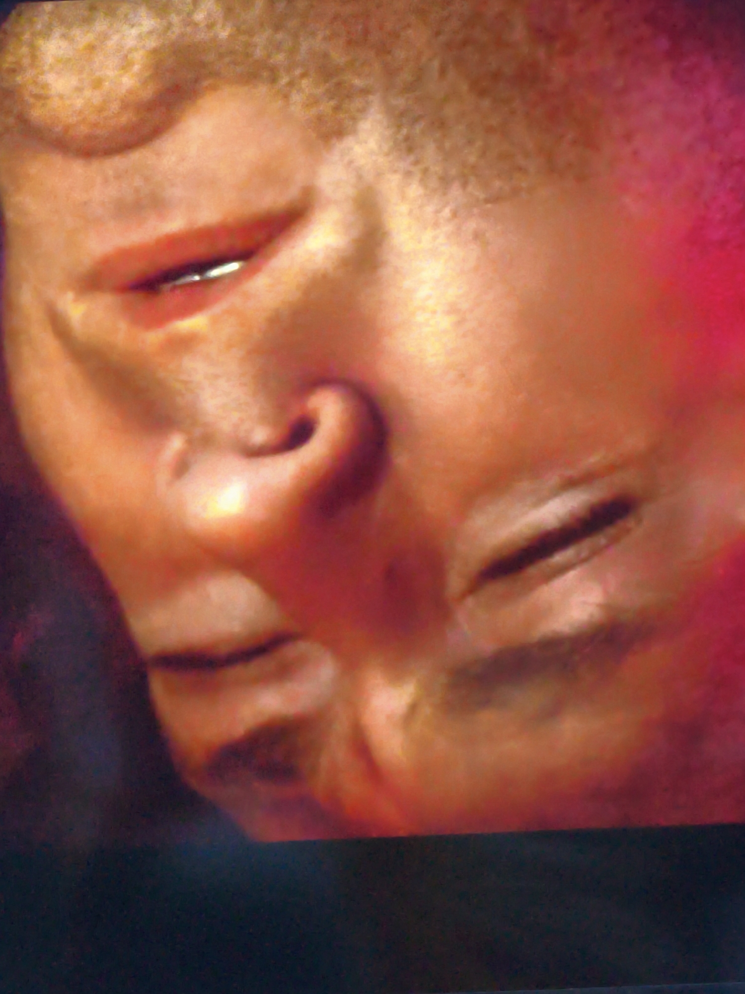 The image is a close-up, low-angle shot of a person's face. The person's mouth is partially open, revealing some teeth. The lighting is dramatic, with strong shadows and highlights, creating a somewhat distorted and abstract view of the face. The background is dark, with some areas of reddish and pinkish light that may be reflections or ambient lighting. There is no discernible urban environment or specific location identifiable in Vladivostok, Russia. The image focuses solely on the facial features of an individual.