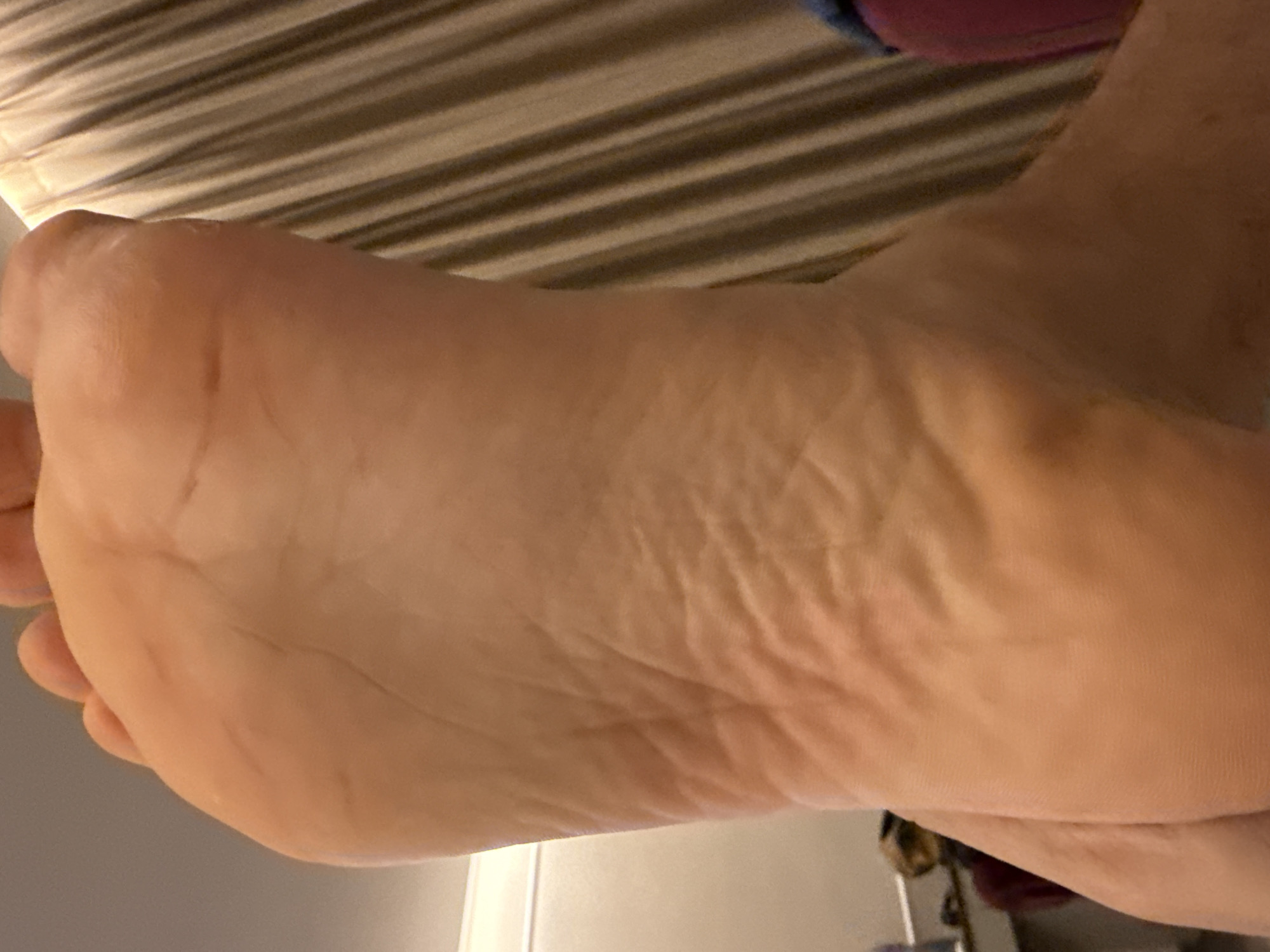 A close-up photograph shows the sole of a human foot. The skin is light in color and has wrinkles. The background is blurry and shows a striped pattern, possibly a bed sheet, and a section of a doorframe or wall. The image does not include a location in a city.