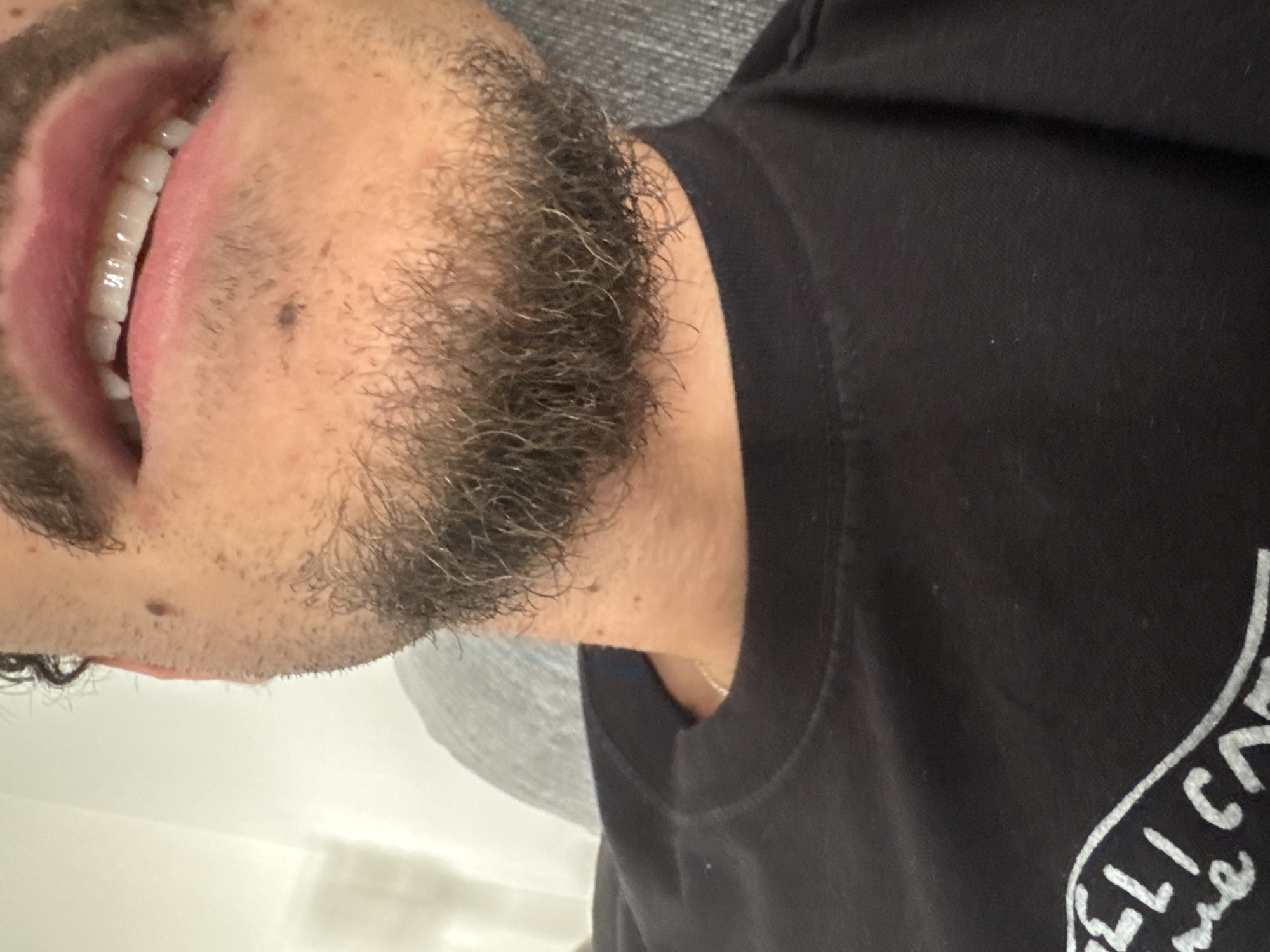 The image is a close-up, horizontally oriented shot of a person's lower face, neck, and upper chest, seen from a side profile. The subject has a dark, curly beard with some visible grey hairs, covering their cheeks and chin. Their lips are slightly parted, revealing clean, white upper teeth. The skin tone is light to medium, with some stubble visible and a small mole present on the cheek/jawline area.
The person is wearing a black t-shirt with a rounded neckline. A faint, thin gold chain is visible around their neck. On the black t-shirt, part of a white, stylized text or logo is visible, appearing to spell "PELI CAN". The background consists of a light grey, textured surface (possibly fabric like a pillow or blanket) behind the person's head and a lighter, out-of-focus area, possibly a wall, to the lower left.
The activity appears to be the person's mouth slightly open, which could indicate a relaxed expression or a subtle smile. No specific time of day or weather is discernible from the indoor setting. The location context of Redondo Beach, United States of America, is provided but not explicitly identifiable from the visual content. The image captures a casual and personal moment.