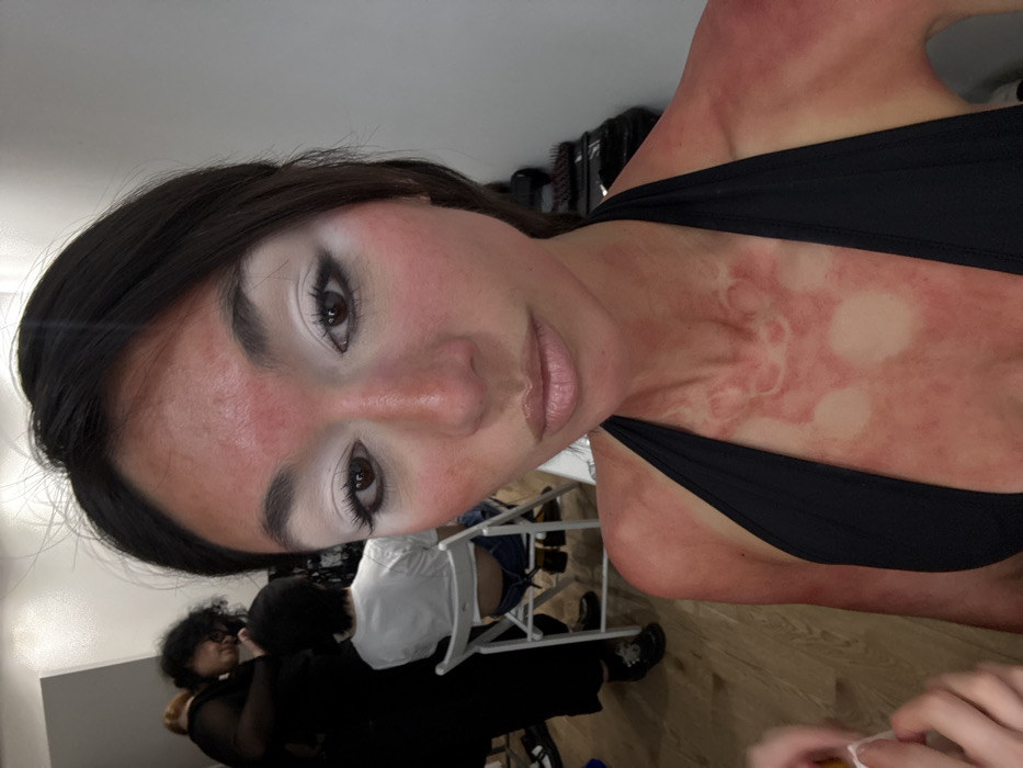 A woman with dark hair and fair skin poses close to the camera. Her face, neck, and shoulders appear sunburnt or covered in red makeup, with distinct, uncolored circular patches on her chest. She wears a black top. Behind her, partially visible, are two people, one seated in a chair, and salon equipment. The photo is taken at an unusual angle, slightly tilted.