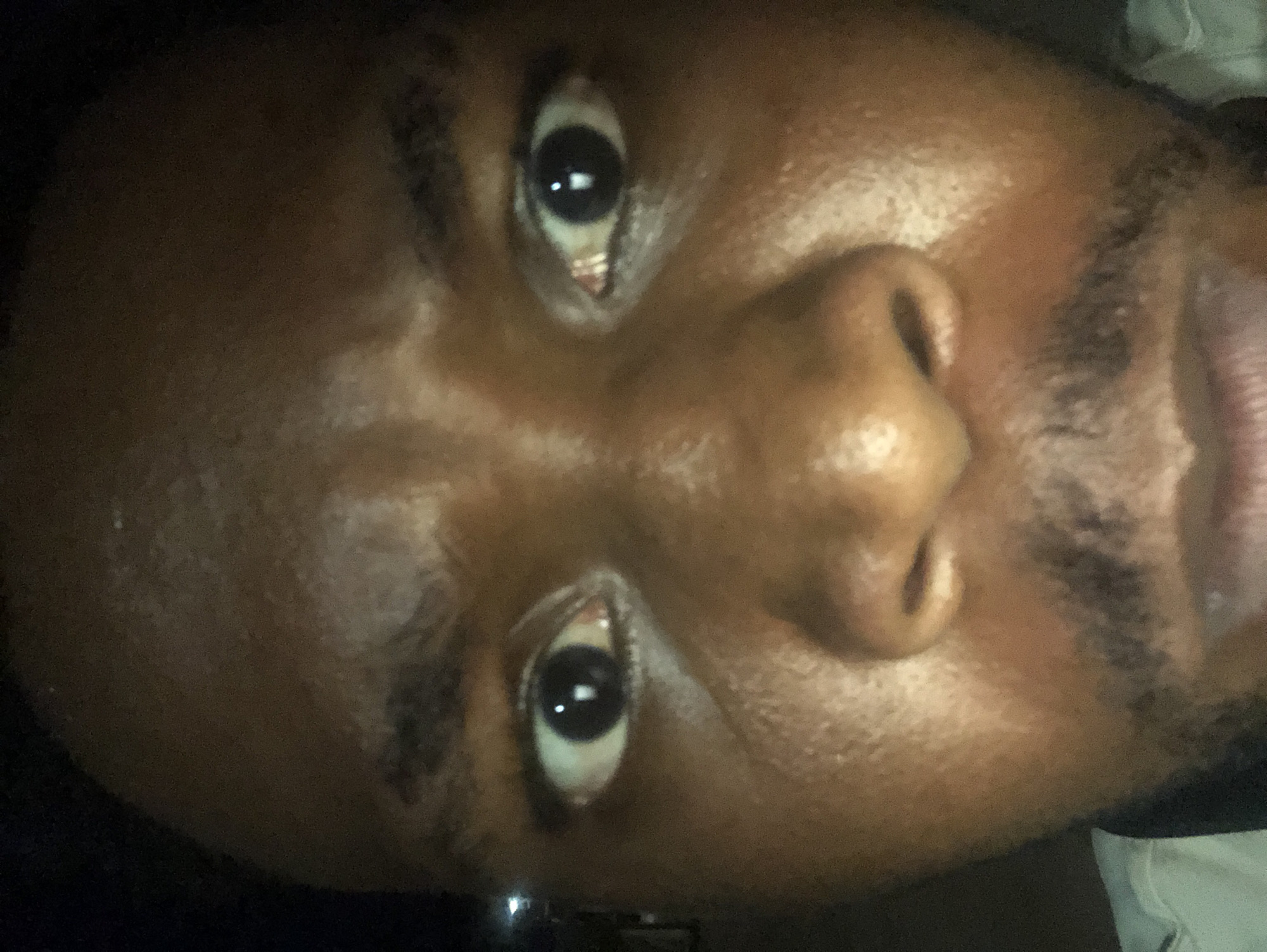 A close-up, rotated view of a dark-skinned person's face. The image captures the person's eyes, nose, and a portion of the mouth and beard. The person's face appears to be slightly shiny. The location and specific environment are indeterminable from the image.