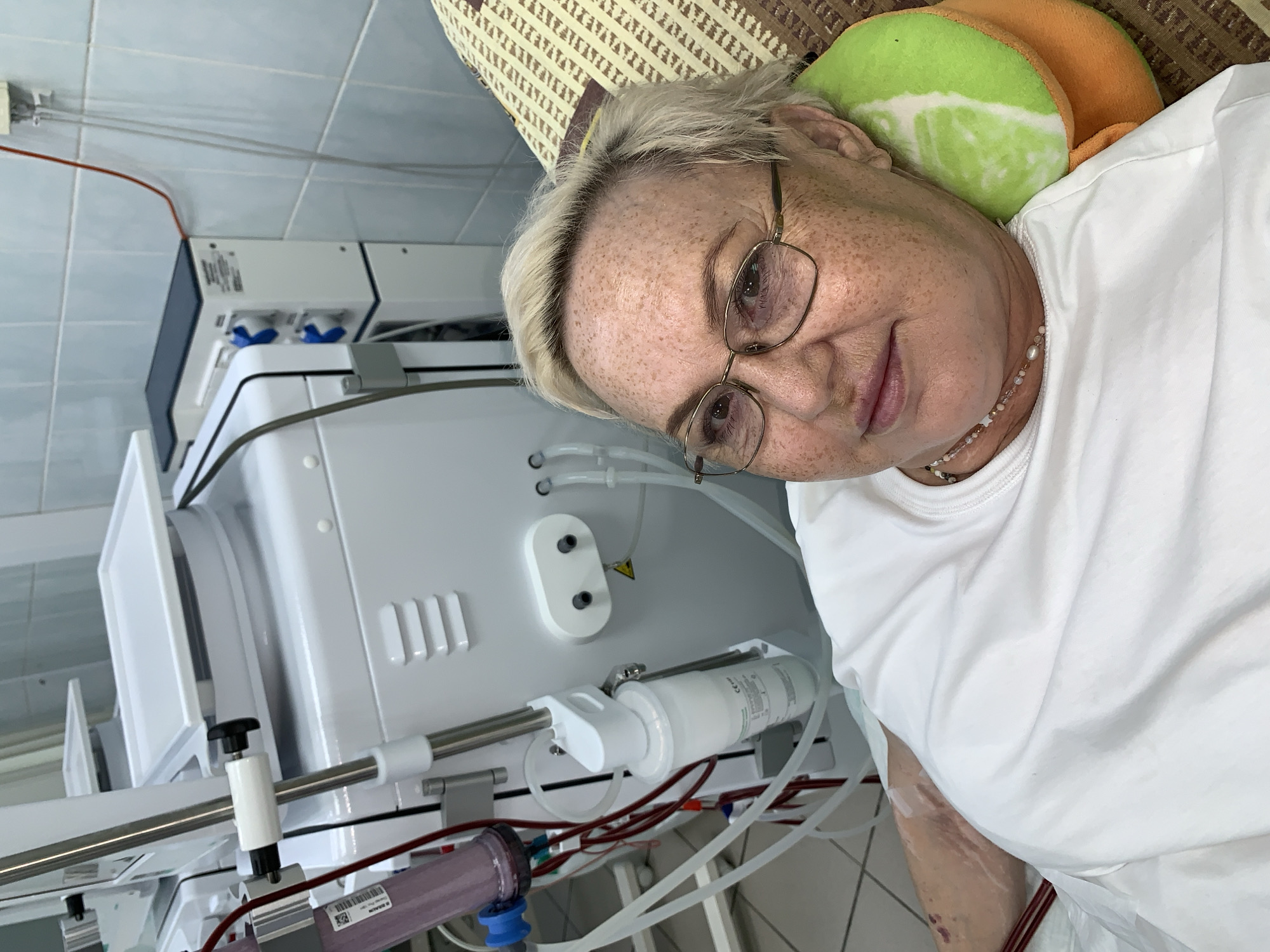 A fair-skinned, light-haired woman with freckles, wearing a white t-shirt and glasses, is lying on a bed with a patterned blanket and a green and orange pillow behind her head. She is positioned in what appears to be a medical setting, with a large white dialysis machine to her left. The machine has various tubes and components, including a pink filter. The background shows a tiled wall and other medical equipment. The scene is likely within a healthcare facility, possibly a hospital or clinic, in the city of Chaikovsky, Russia.