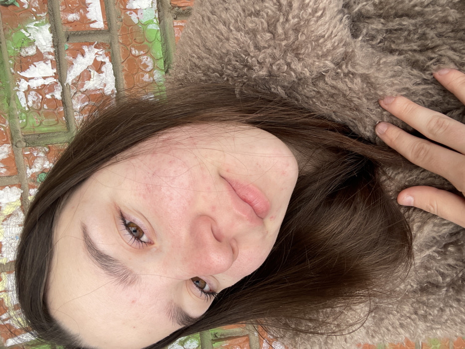 A close-up, slightly angled portrait depicts a single young female in the city of Ольховка, Russia. The subject's head is tilted to her right, and her eyes, which are brown, are directed towards the camera. She has long, dark brown hair, framing her face. Her fair skin displays multiple small, reddish blemishes across her forehead, cheeks, and chin. Her lips are full and exhibit a subtle, natural curve. She is clad in a textured, light brown, curly-pile garment. Her left hand is positioned in the lower right frame, resting on the garment near her chest. The background consists of a brick wall composed of orange-red bricks, partially obscured by peeling white paint or plaster and irregular green markings.