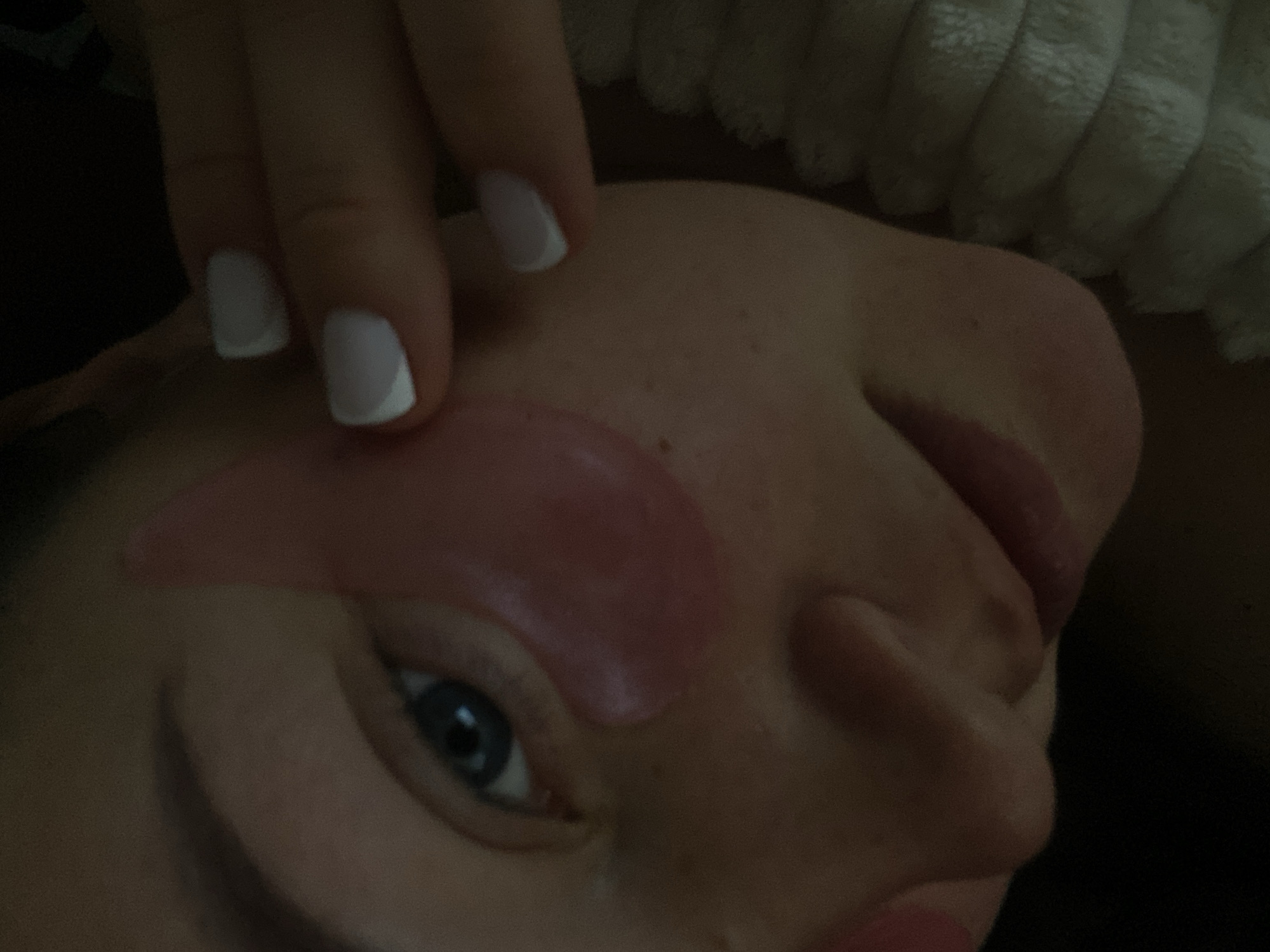 Close-up of a person's face with a pink under-eye patch, fingers with white-tipped nails touching the forehead, and a textured white fabric near the head. It is not possible to determine the location is Sochi, Russia from this image.