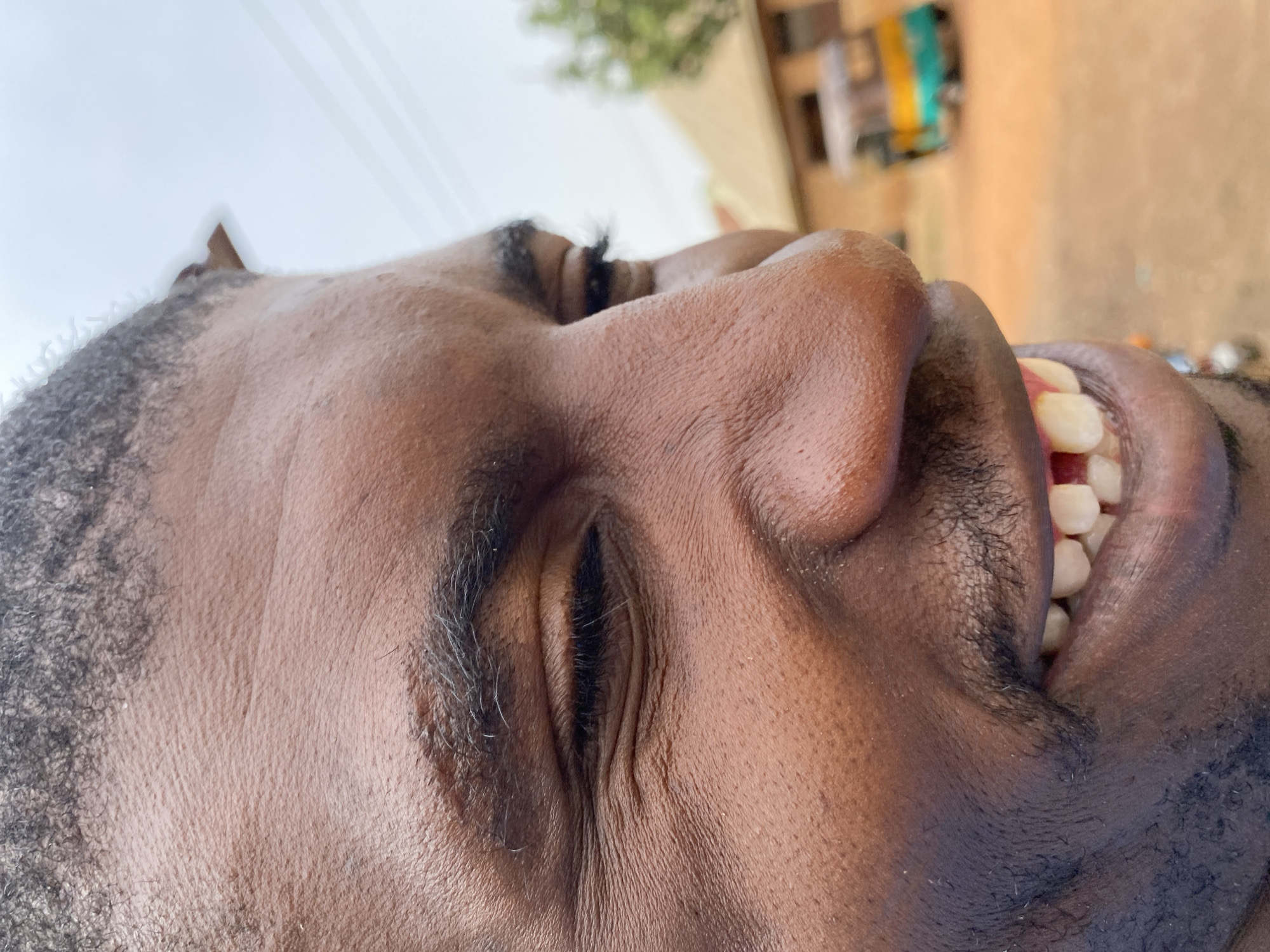 A close-up photograph shows the face of a dark-skinned individual with their head tilted back, eyes nearly closed, and mouth slightly open, revealing teeth. The individual has short, dark hair and a beard. The background is blurred but appears to be an outdoor setting in the city of Kuru Karama, Nigeria, with indistinct building structures, vegetation, and a vehicle visible in the distance.