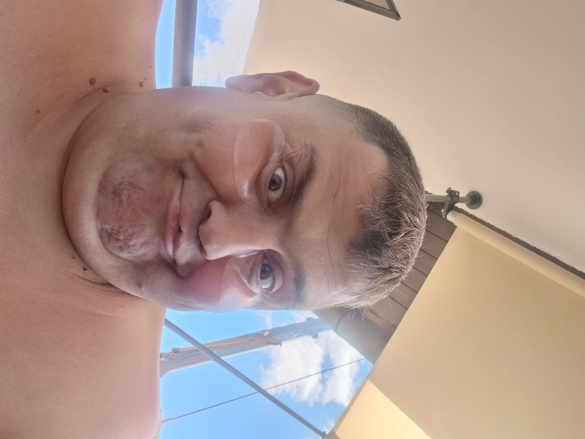 A man, appearing to be in his late 30s or early 40s, is taking a selfie outdoors. He has short, graying hair and is looking directly at the camera with a somewhat exaggerated facial expression. He is wearing under-eye masks. The background consists of a bright blue sky with white clouds and a beige awning or canopy. The man's bare shoulders are visible, and there are several moles on his neck and upper chest. The overall impression is casual, possibly taken during a vacation or relaxation period. The specific location in Pfarrkirchen, Germany, is not identifiable from the image itself.
