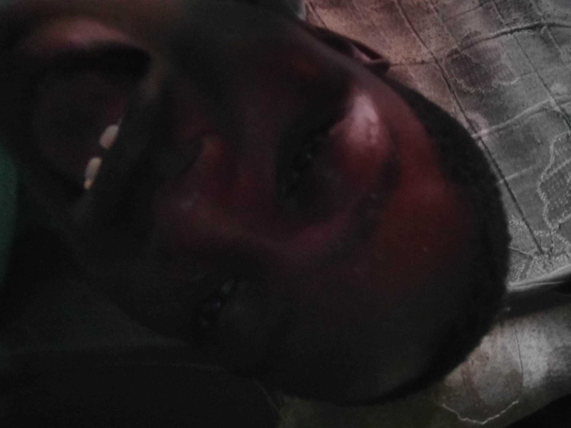 A close-up, poorly lit photograph depicts a person's face, likely a young male, lying on what appears to be a patterned bed sheet or blanket. The person is dark-skinned, with short hair. The mouth is slightly open, revealing teeth. The lighting is dim and obscures details. There is no specific evidence of the city of Shangisha, Nigeria, in the image. The image consists of a portrait of a person's face, lacking any clear markers of location, interaction, or specific action. The setting seems to be indoors, based on the textile underneath the person.