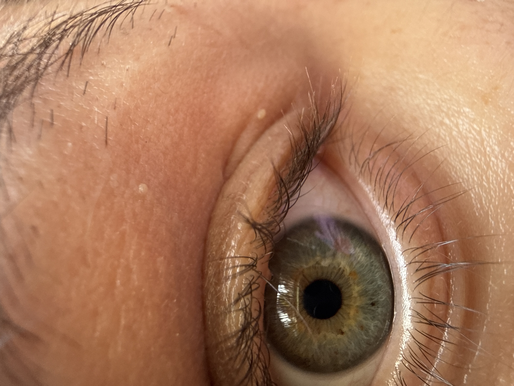 A close-up, high-magnification image depicts the right human eye and surrounding periorbital skin of an unidentified individual in the city of Delmenhorst, Germany. The iris presents a hazel color with a blend of green-blue and brown/gold flecks, particularly around the centrally located, dilated black pupil. Upper and lower eyelashes are dark, numerous, and curled, with several individual lashes exhibiting small, bright, reflective particles. The skin above and below the eye is a fair-to-medium tone, displaying fine lines, visible pores, and fine vellus hair. Multiple small, white, spherical epidermal cysts, consistent with milia, are present on the upper eyelid and the skin extending towards the eyebrow. One similar but slightly larger lesion is observed on the skin inferior to the outer canthus. A distinct reflection of a light source is visible on the corneal surface and within the pupil, and a subtle purplish reflection is present on the iris. Dark, coarse eyebrow hairs are partially visible at the top-right periphery of the image.