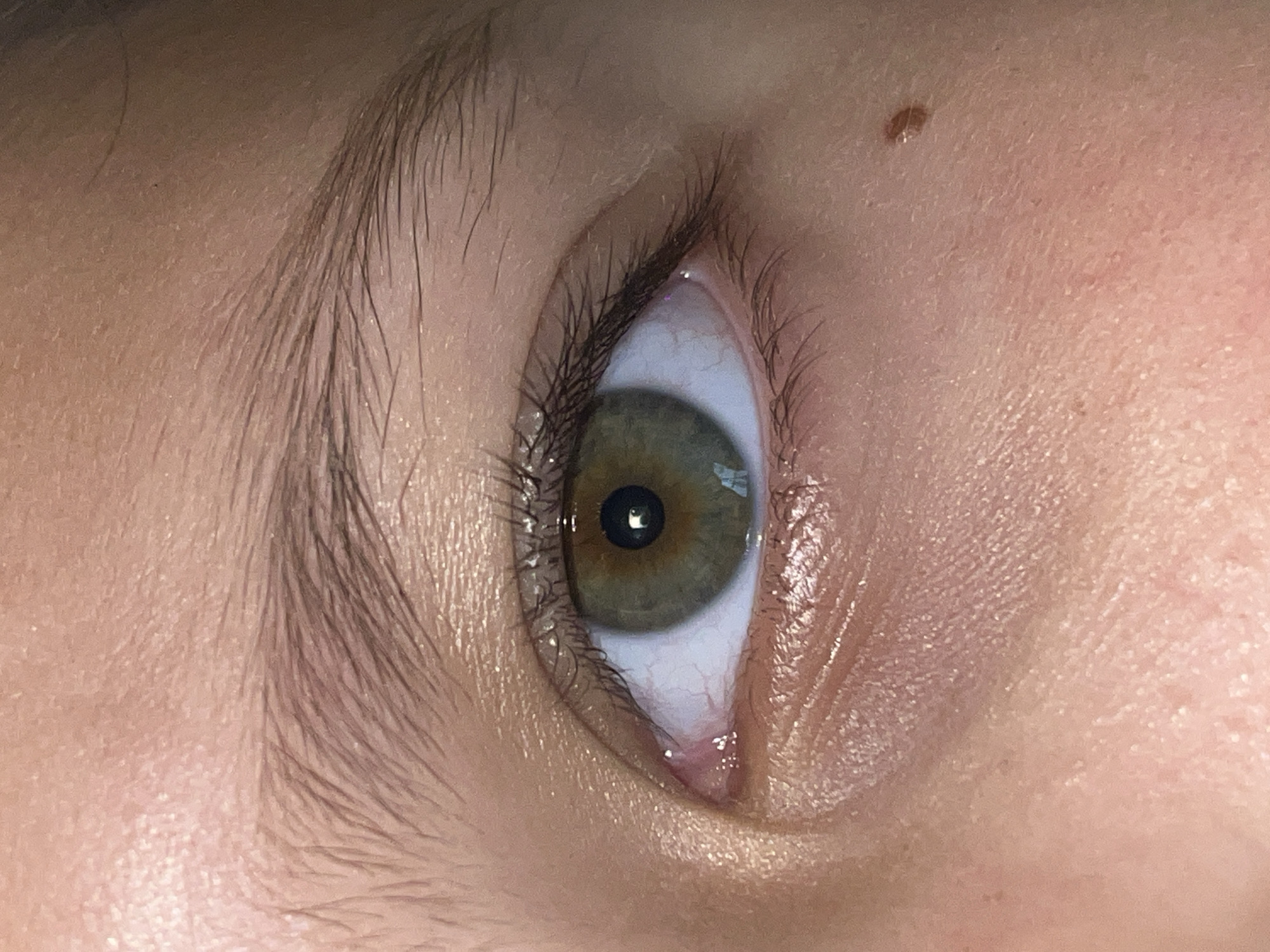 A close-up image of a human eye, hazel in color, angled upwards and slightly to the left. Visible surrounding skin, eyebrow, and eyelashes. A mole is present on the skin above the eye. The eye is bloodshot on the inner corner. The environment consists of a human face. There is no indication of Novopokrovskaya, Russia.