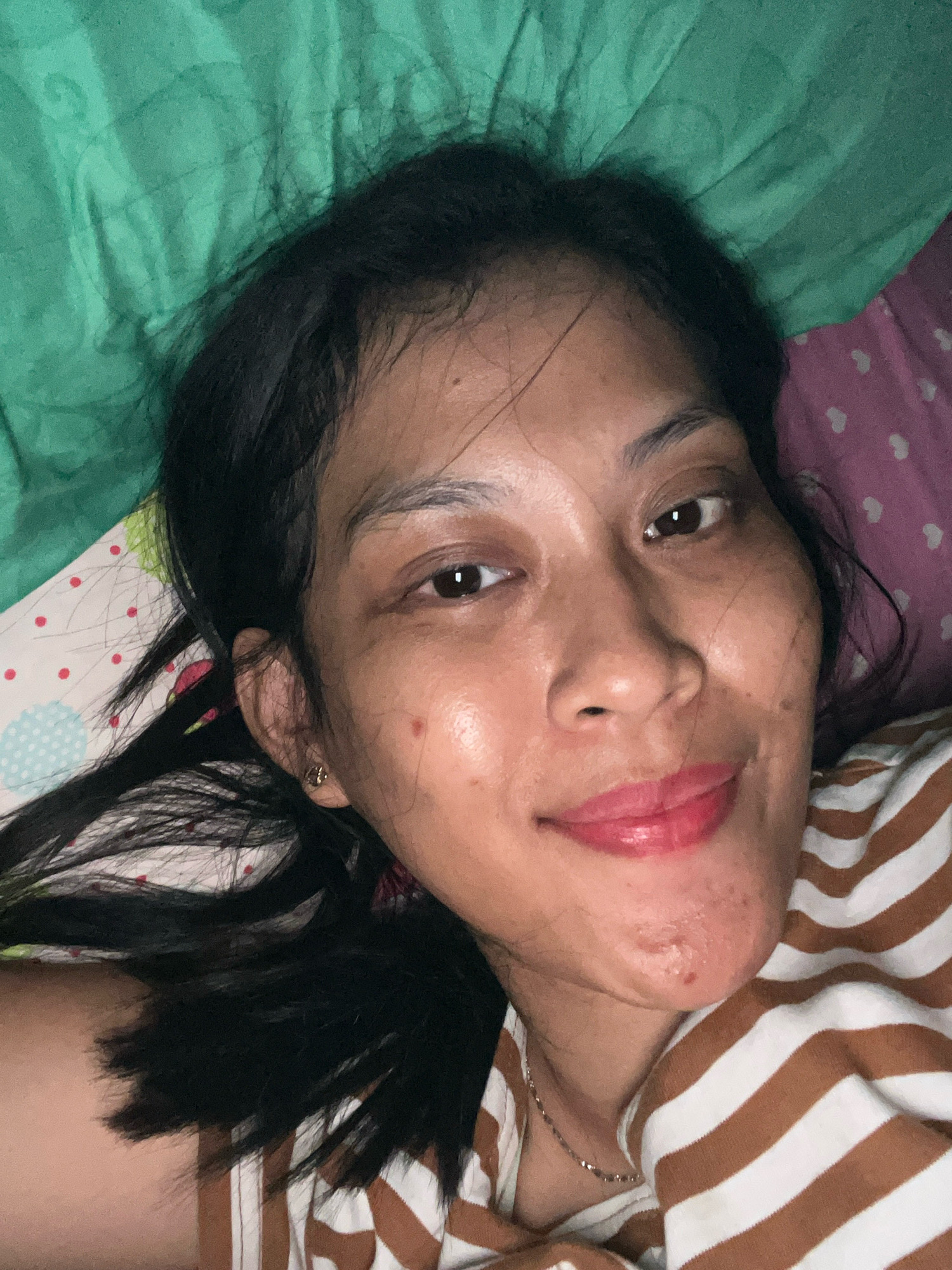The image is a close-up, overhead shot of a young woman lying down. She has dark hair, brown eyes, and is wearing a brown and white striped shirt. Her skin appears slightly oily, with some blemishes visible on her face and chin. She is wearing lip gloss and a subtle earring. The background consists of colorful bedding. The scene suggests a casual, personal moment, possibly in a bedroom. No specific details indicating the city of Kecamatan Pati, Indonesia are present in the image.