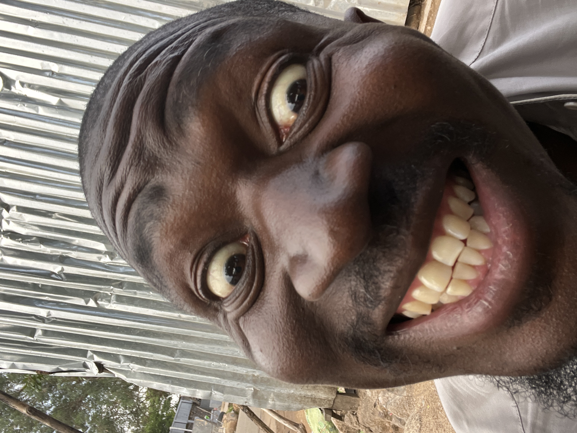An extreme close-up, rotated portrait of a Black man, likely a selfie, captures him making an exaggerated facial expression. His head is tilted significantly, and his face fills most of the frame due to a wide-angle lens effect which distorts his features. He has dark skin, a mustache, and a short beard. His eyes are wide open and bulging, revealing yellowish sclera and dilated dark pupils, suggesting surprise or an intense gaze. Deep wrinkles are visible across his forehead from his raised eyebrows. His mouth is open in a broad, almost grimacing smile, revealing many clean, light yellowish-white teeth.
The background is partially obscured and out of focus but shows corrugated metal sheeting, likely a wall or roof, on the left side. To the right and below, hints of an outdoor setting are visible, including trees, foliage, and uneven ground. A light-colored shirt, possibly white or light gray, is visible on his right shoulder and chest area. The scene is illuminated by daylight, indicating it's daytime. The man's expression conveys a sense of playful surprise, humor, or intense animation. There is no visible text. The setting is an outdoor location in Jos, Nigeria.