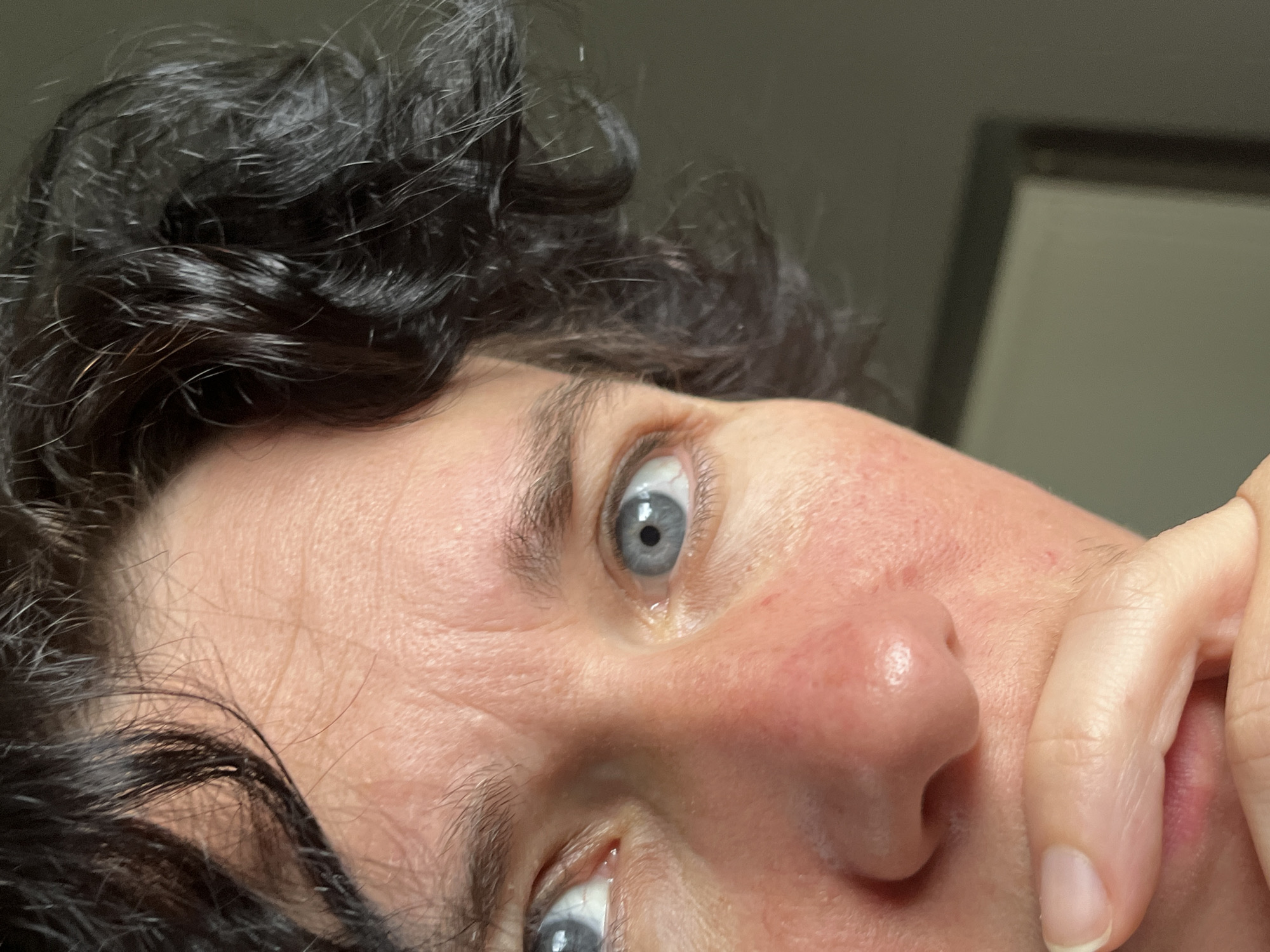 The image is a close-up, chest-up, angled shot of a person's face, specifically focusing on their eyes, nose, and mouth, with their hand covering part of their mouth and chin. The person has dark, curly hair, light-colored eyes, and fair skin with some redness on the cheeks. The background is blurred and appears to be an indoor setting with a dark wall and a partially visible frame or object. There is no identifiable information in the image or its crops that would suggest a specific location in Ureki, Georgia, or any urban environment. The description is limited to visual elements present in the provided images.