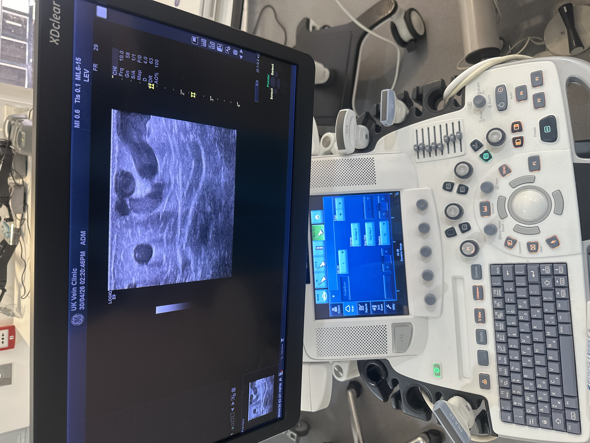 The image displays an ultrasound machine with its monitor and control panel, situated in what appears to be a medical examination room or clinic. The large monitor, branded "XDclear," shows a greyscale ultrasound image with cross-sections of what look like blood vessels, indicative of a vascular scan. Text on the screen identifies the machine as a "GE LOGIQ E9" and the facility as "UK Vein Clinic," confirming a medical, specifically phlebology, setting.
The monitor also displays technical parameters such as "MI 0.6," "Tls 0.1," "ML6-15," "FR 29," "Frq 10.0," "Gn 58," "D 4.0," and "DR 63," which are typical ultrasound settings. The date and time "30/04/26 02:20:46PM" are visible, suggesting an afternoon examination. Below the main image, a smaller preview section shows another ultrasound image with the timestamp "30/04/26 02:27:15PM."
The control panel of the ultrasound machine is visible on the right, featuring a keyboard, various buttons for functions like "Freeze," "Auto," "Depth," "Zoom," and different imaging modes (B-mode, M-mode, PW, CW, CF). Several ultrasound probes, including one labeled "ML6-15," are resting in their holders on the machine. The overall scene suggests an active diagnostic session or recent use of the equipment for vascular assessment in a clinic located in the UK.