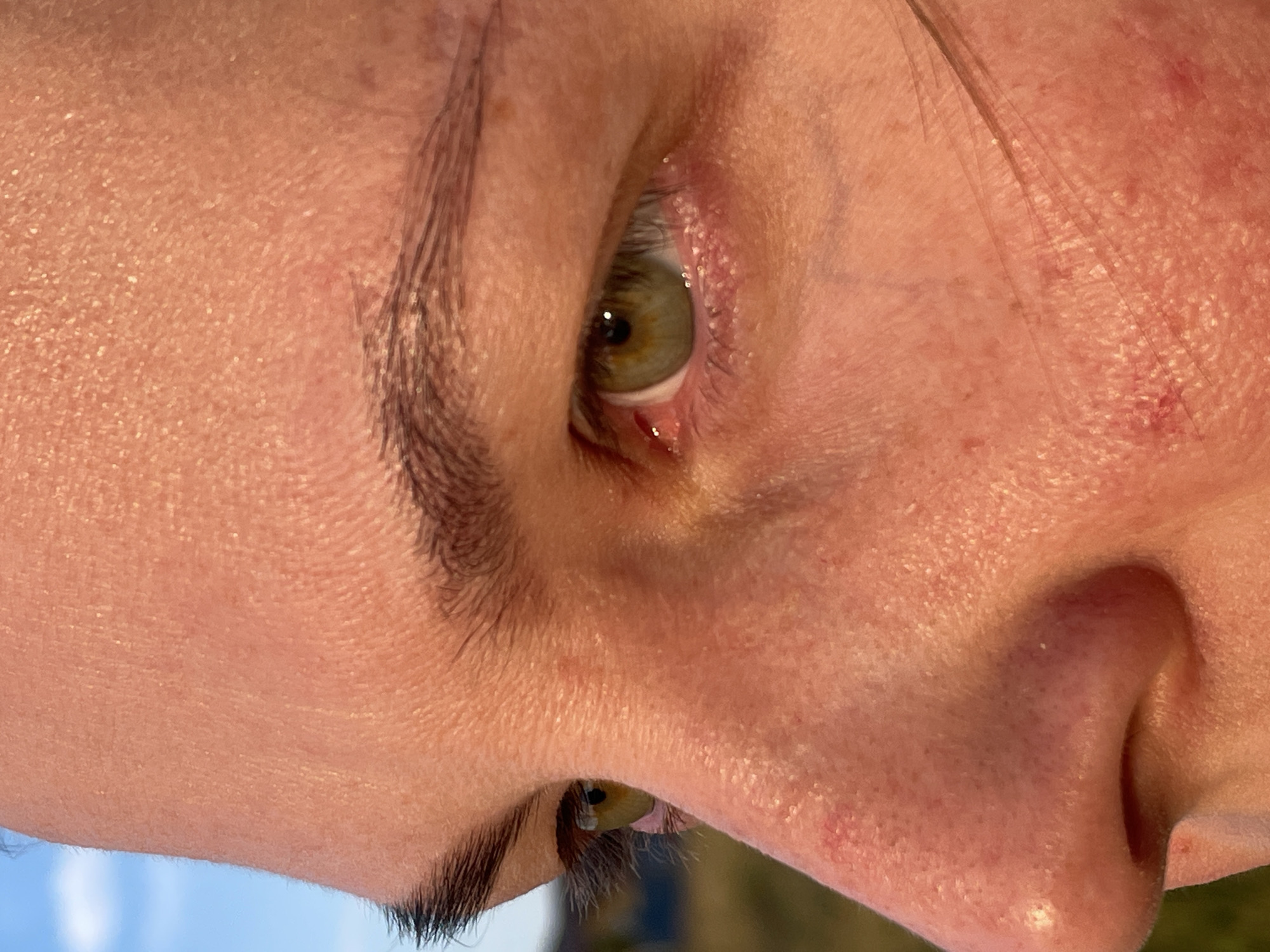 This is a close-up, profile view of a person's face, focusing on the eye and nose area. The lighting suggests it is daytime, possibly late afternoon or early morning, with a warm, golden hue illuminating the skin. The background is out of focus and appears to be an outdoor environment with a pale blue sky and hints of greenery and possibly hills. The individual has fair skin with some visible pores and a few reddish blemishes or freckles. Their eye is open and looking to the left, revealing a light green iris. The eyebrow is dark and well-defined. A few strands of hair are visible across the cheek. The nose is also in profile, with prominent nostrils. The image is cropped such that no specific urban landmarks or any indication of Rostov-on-Don, Russia are visible.