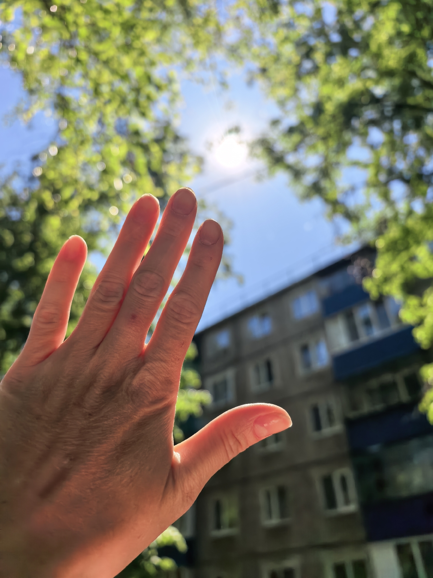 A photograph taken outdoors in Sterlitamak, Russia, shows a hand held up toward the sky, partially obscuring the sun. The hand is open, with the fingers spread apart. The skin on the hand is reddish-pink, possibly due to sun exposure. The background includes a blue sky, bright sunlight, green trees with blurry leaves, and a multi-story apartment building with visible windows. The overall lighting is bright and sunny.