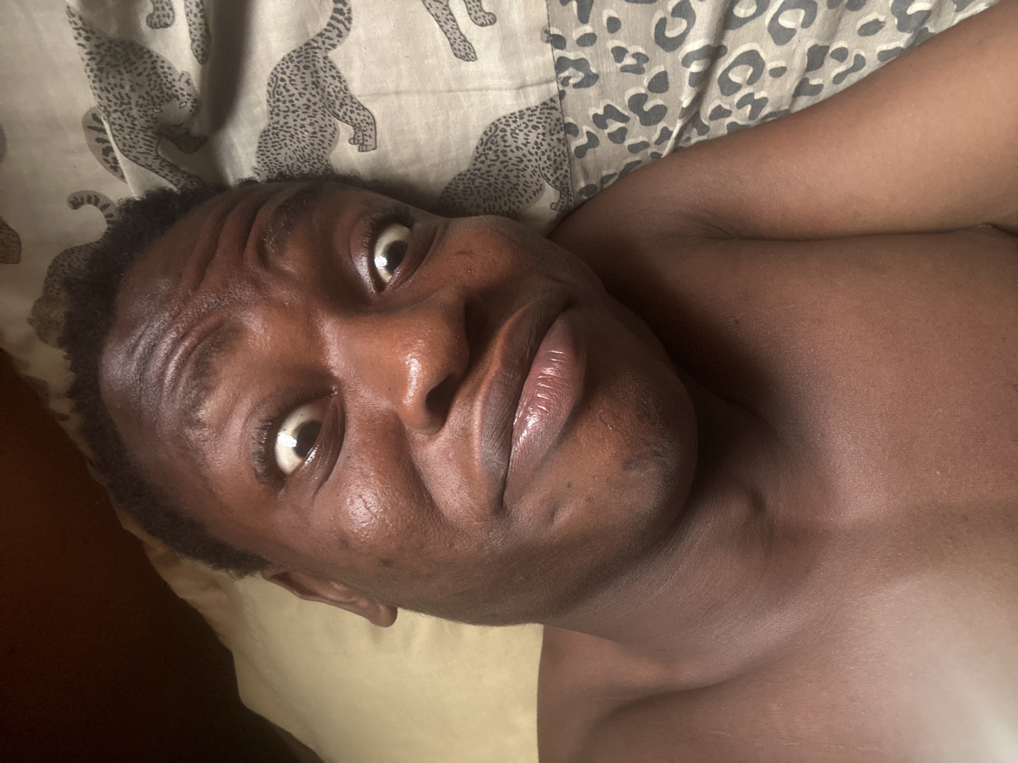 A close-up, indoor shot depicts a dark-skinned person lying on a bed. The person is shirtless, with their head resting on a pillow. The bed is covered with a patterned sheet featuring images of cheetahs or leopards. The person's face is the primary focus, with a slightly furrowed brow and eyes looking towards the camera. The lighting appears to be soft and diffused.