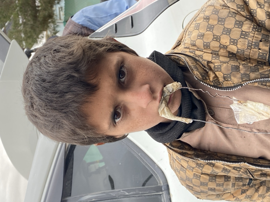 A young male, appearing to be a boy, is centrally depicted in Kandahar, Afghanistan. He has short, dark, textured hair and dark eyes, looking directly at the camera with a serious expression. He wears a dark, ribbed neck warmer, a light brown button-up shirt, and a brown puffer jacket patterned with repeating "BB" logos. A piece of light-colored, crinkled organic material, resembling dried fish skin, protrudes from his mouth. This material is affixed to a thin, coiled metallic wire that extends downward, securing another smaller piece of similar material near his chest. Behind the boy, a light-colored vehicle, possibly an SUV, is partially visible, showing its rear passenger window and an open tailgate or trunk. To the right, partially obscured by the vehicle, an adult male in a blue shirt and brown vest is visible. The scene is outdoors, under an overcast sky, with a hint of green foliage in the distant right background.